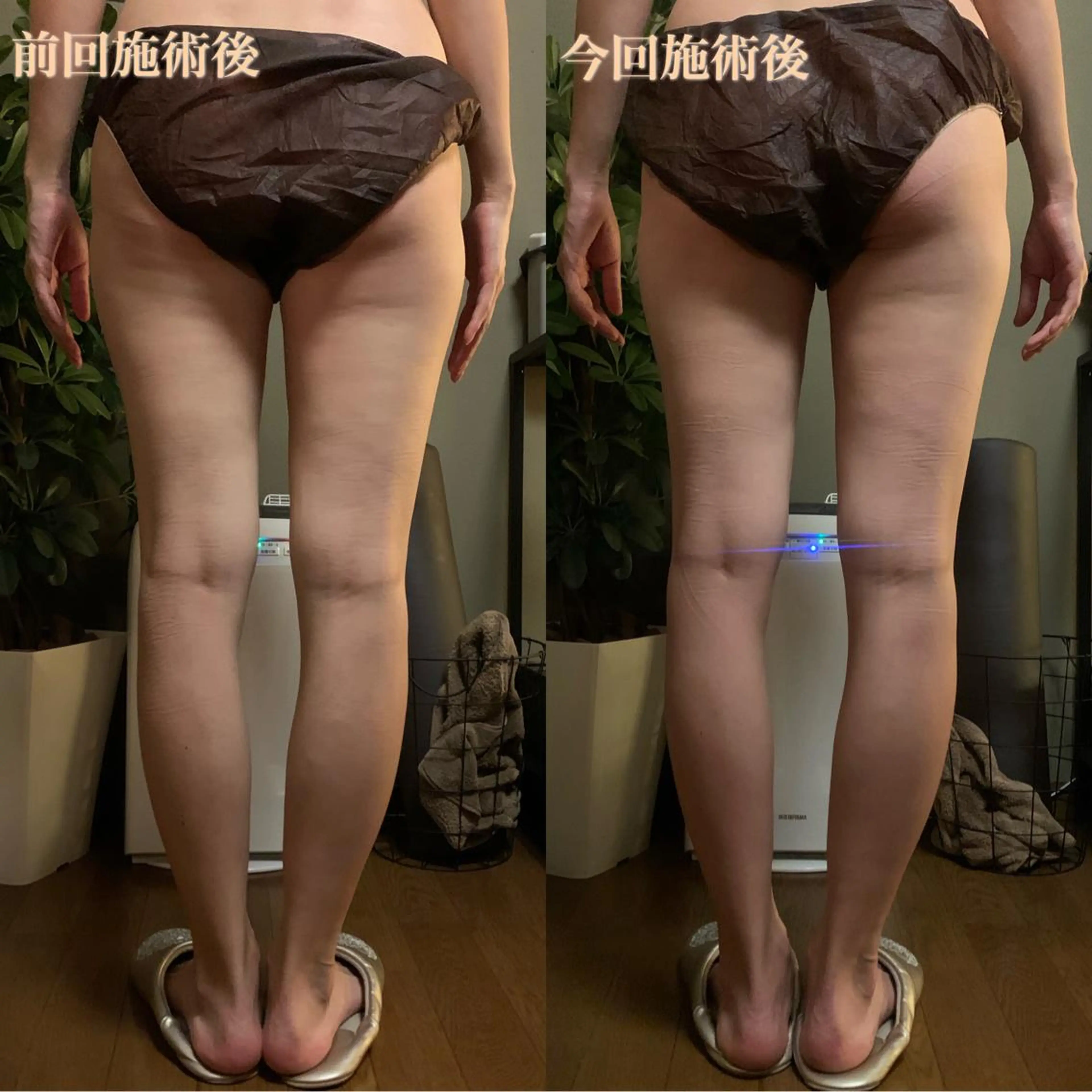 lymph care 'Welnəsのエステ・リラクイメージ