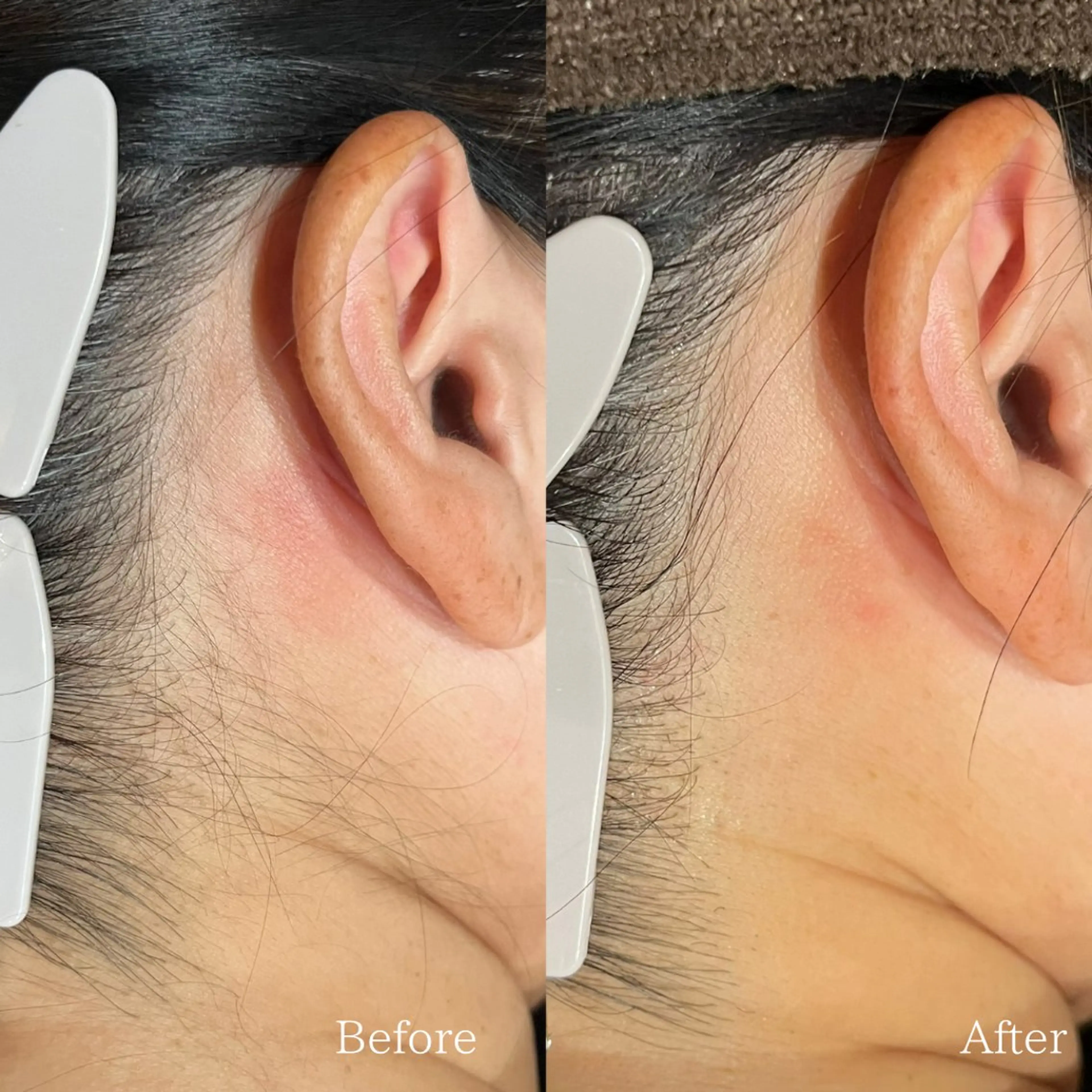 Cre A.所属・プライベートサロン Cre A.のエステ・リラクイメージ