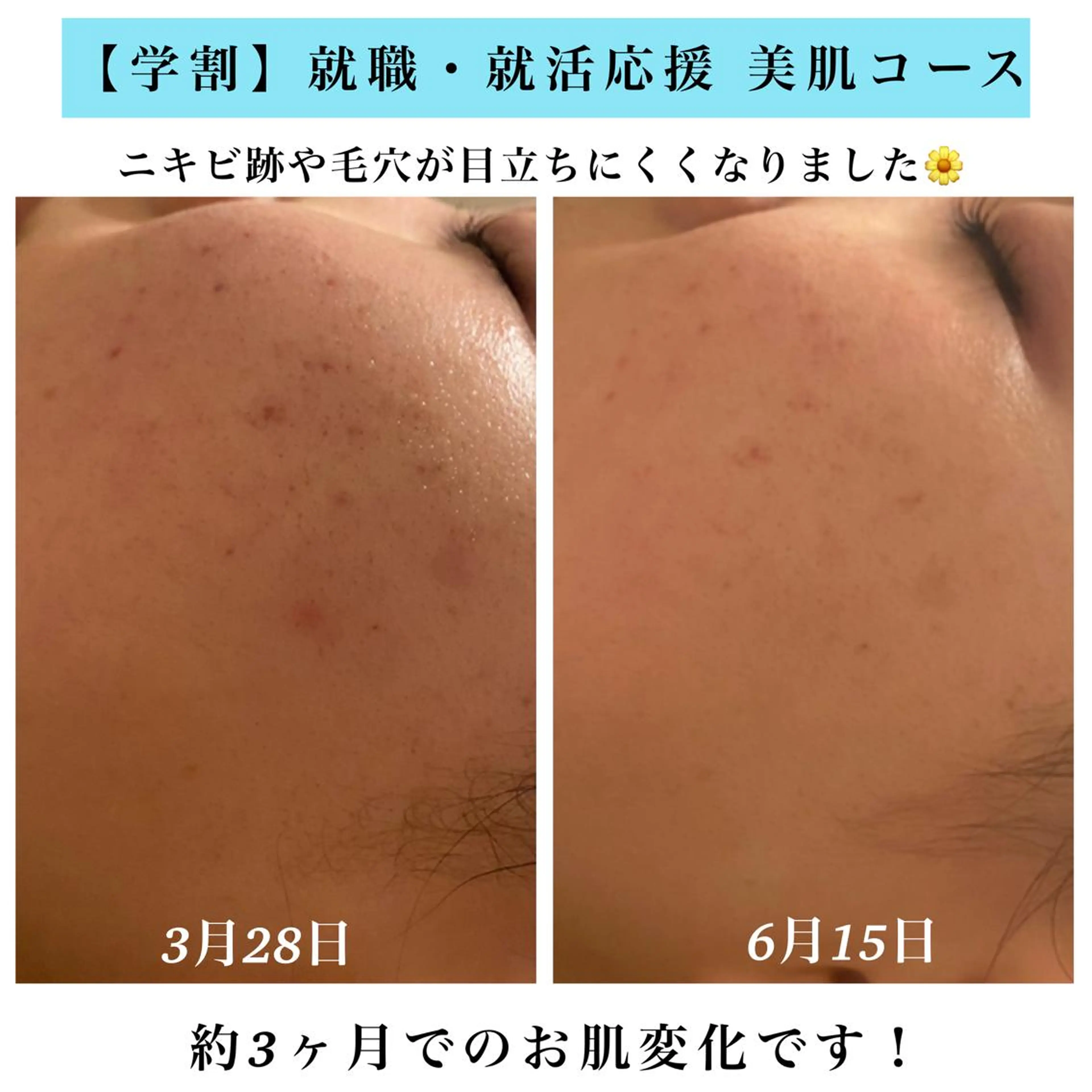 エステ Bellesthe （ベルエステ）のエステ・リラクイメージ