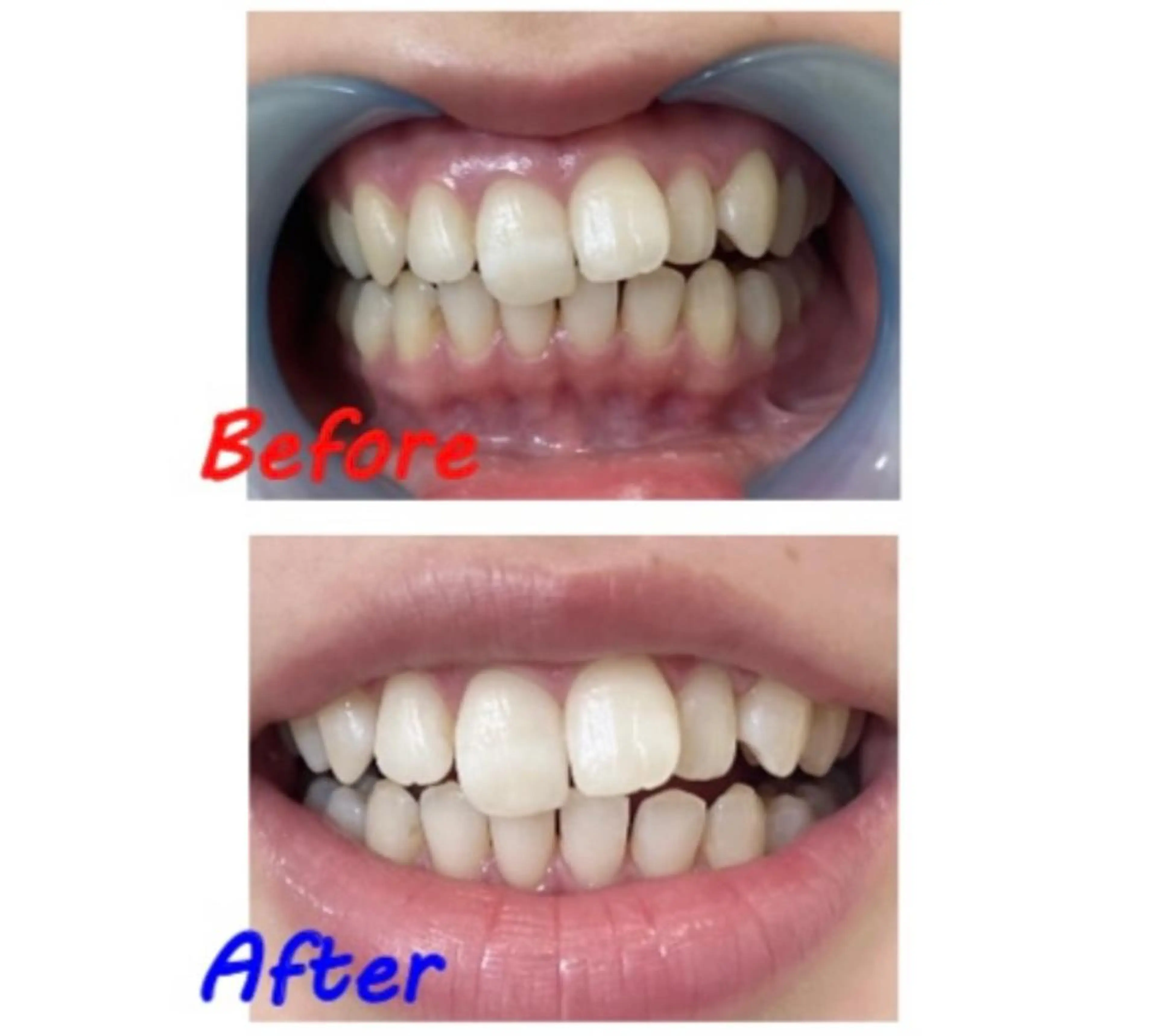 その他 セルフホワイトニングサロン　ラヴィアン所属・ホワイトニングサロン La vie enのその他イメージ