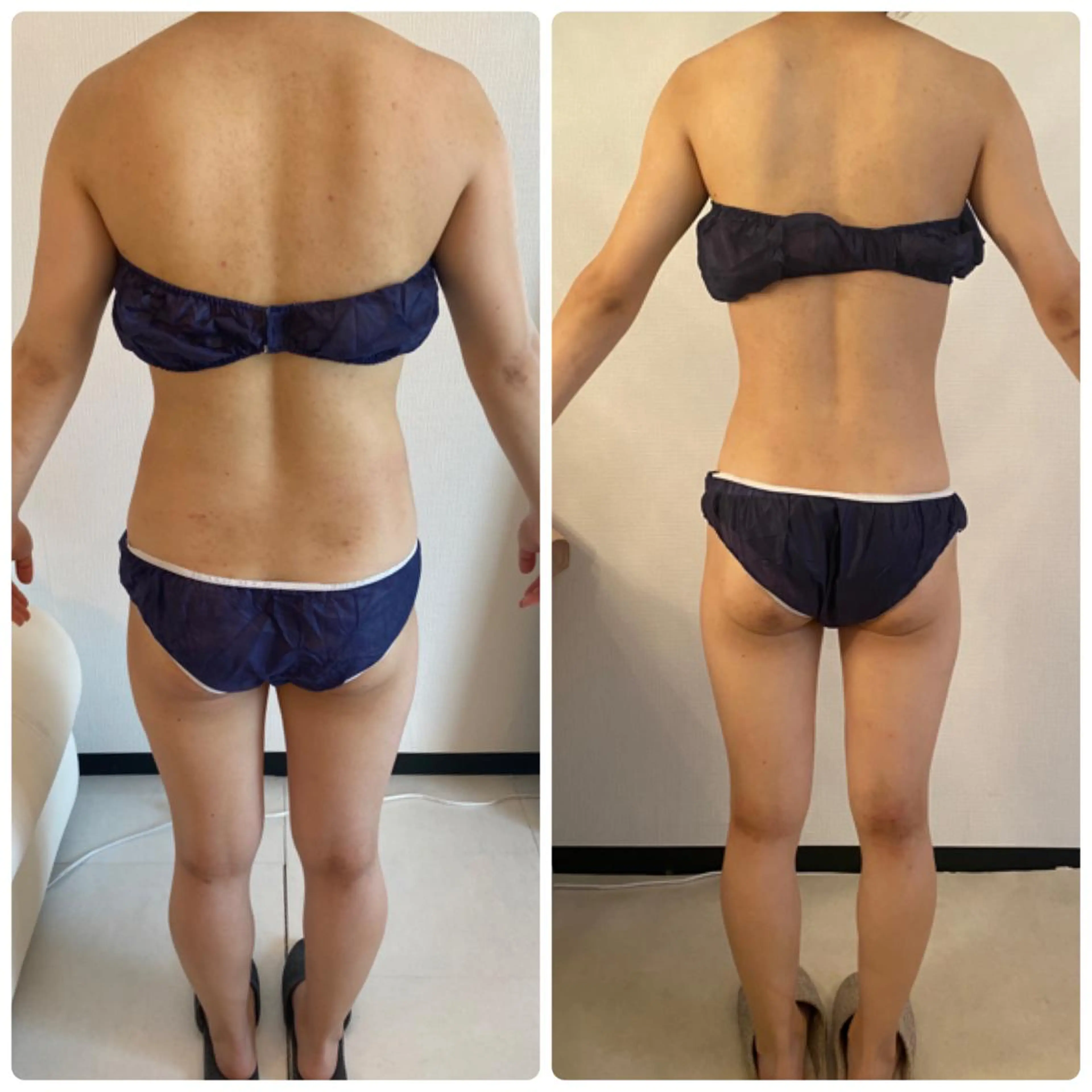 FLEUR大阪・整体 ・ハイフ・痩身・小顔のエステ・リラクイメージ