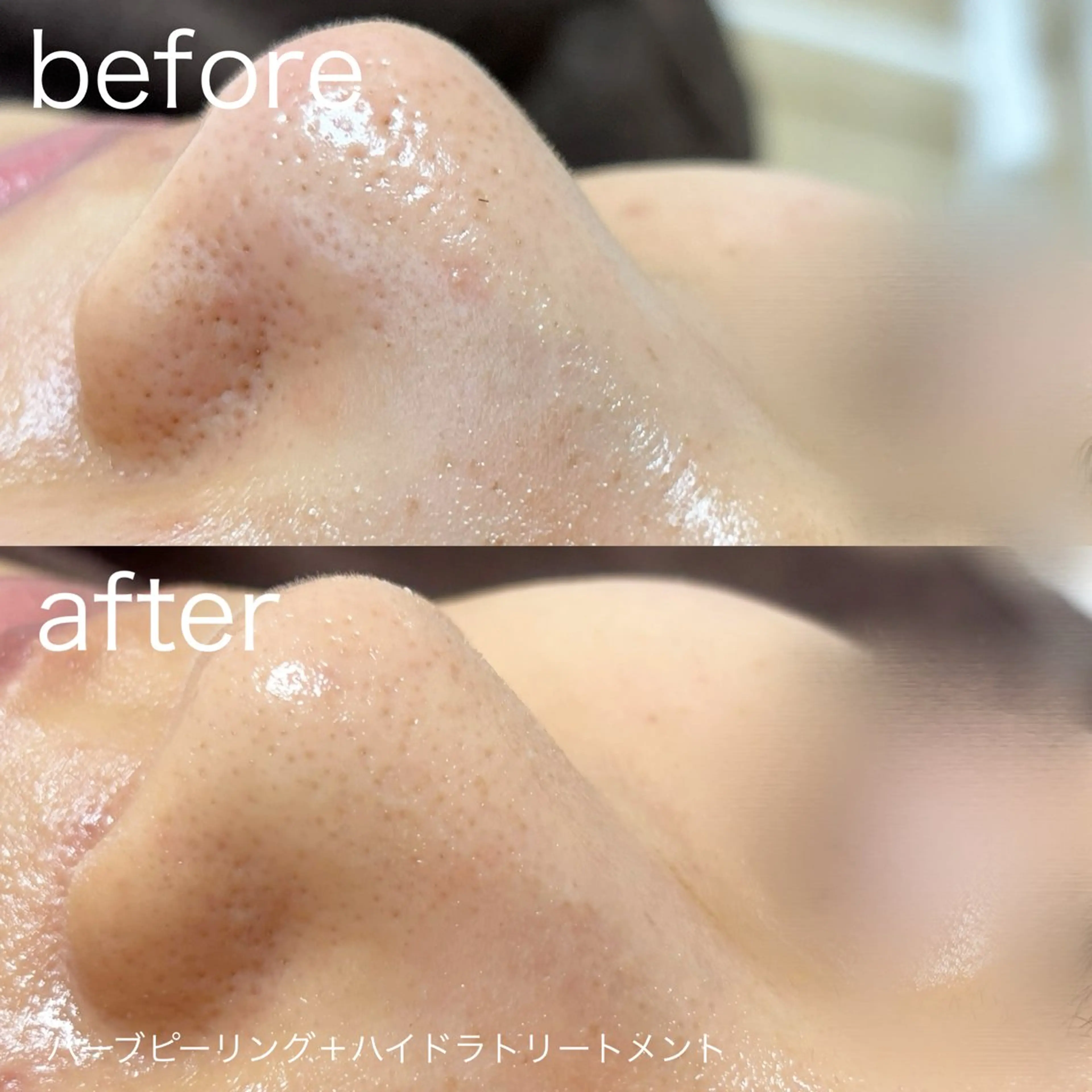 その他 lulularico Yuのエステ・リラクイメージ