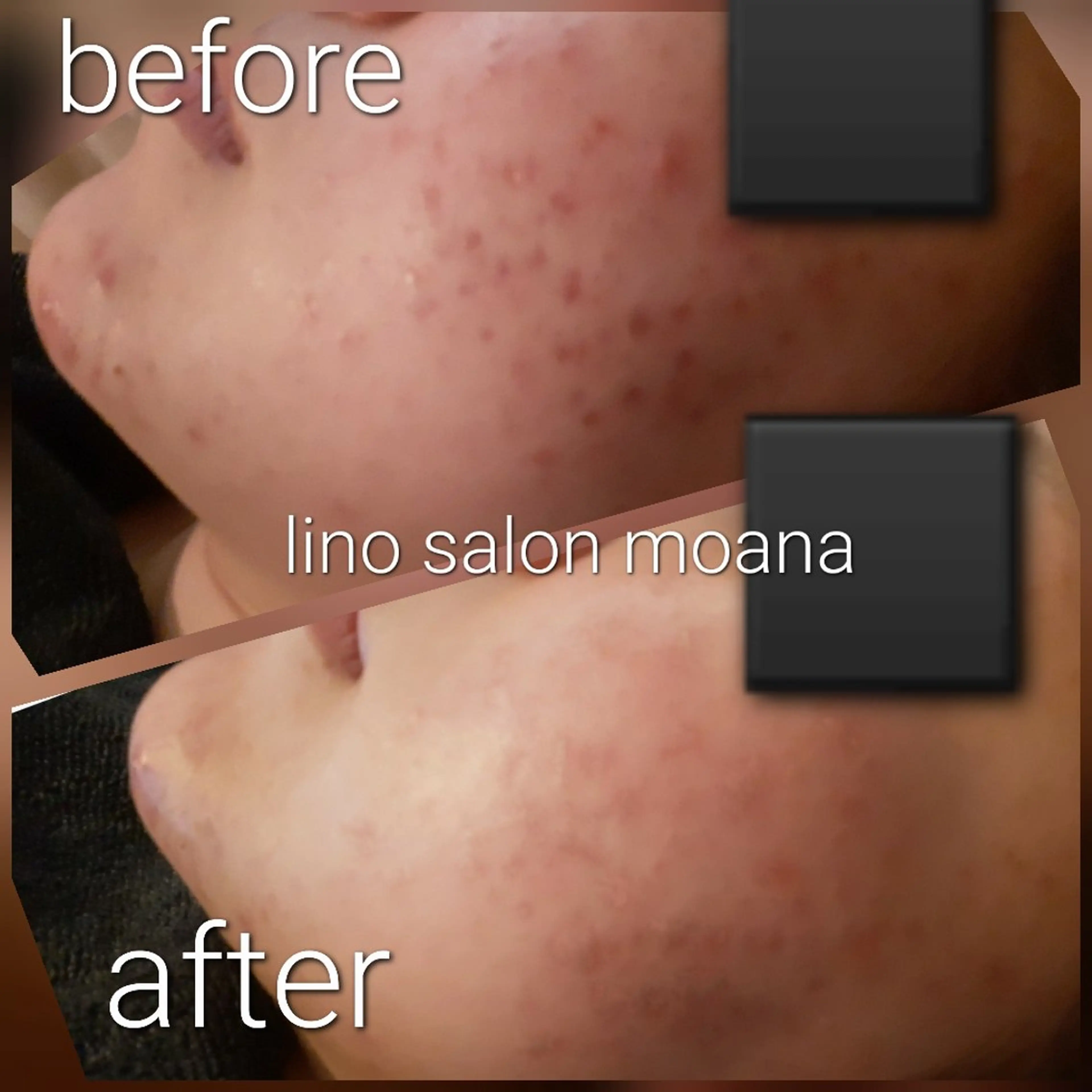 lino salon moana所属・lino salon  moanaのエステ・リラクイメージ