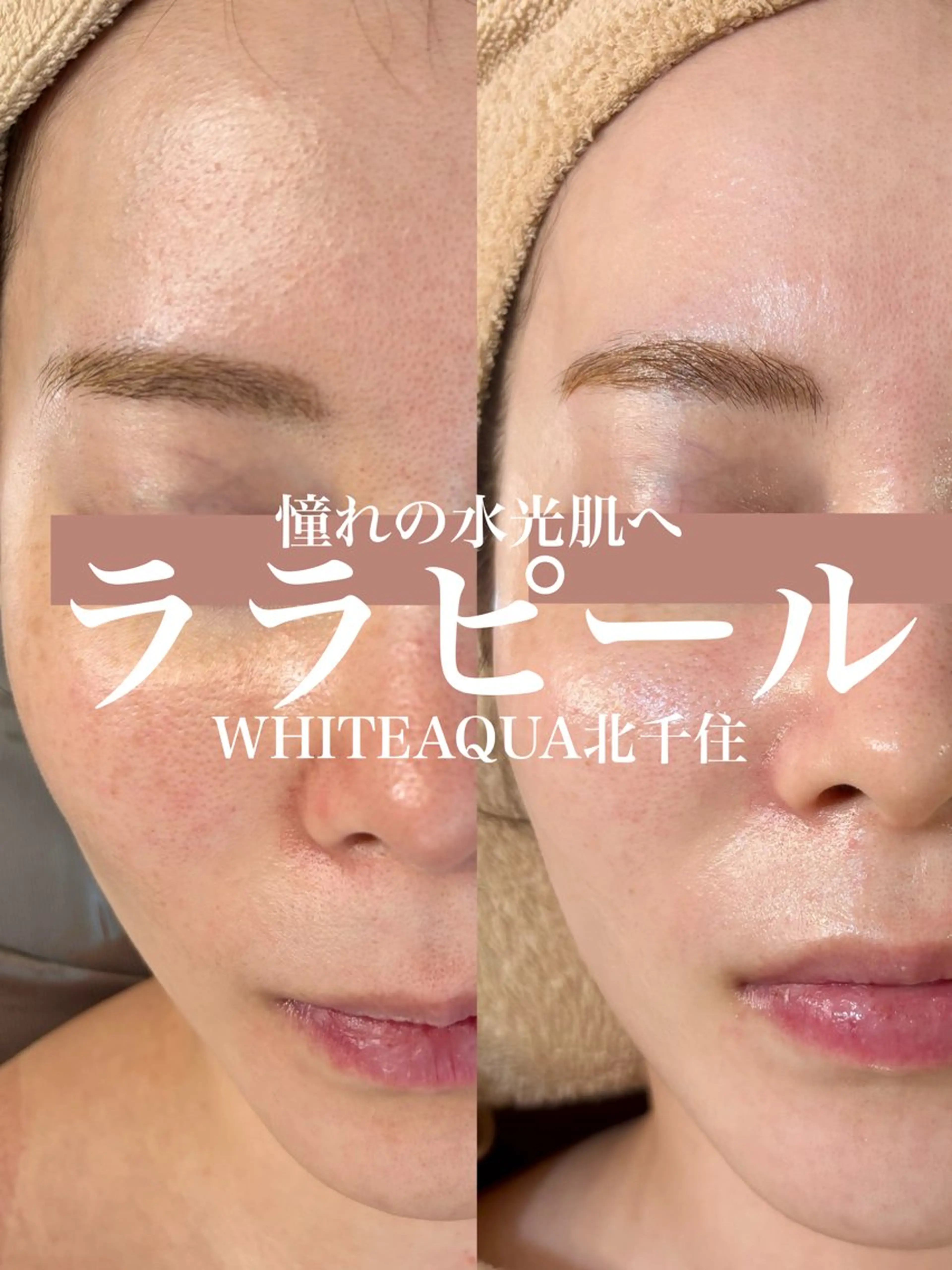 エステ WHITE AQUA 北千住店のエステ・リラクイメージ