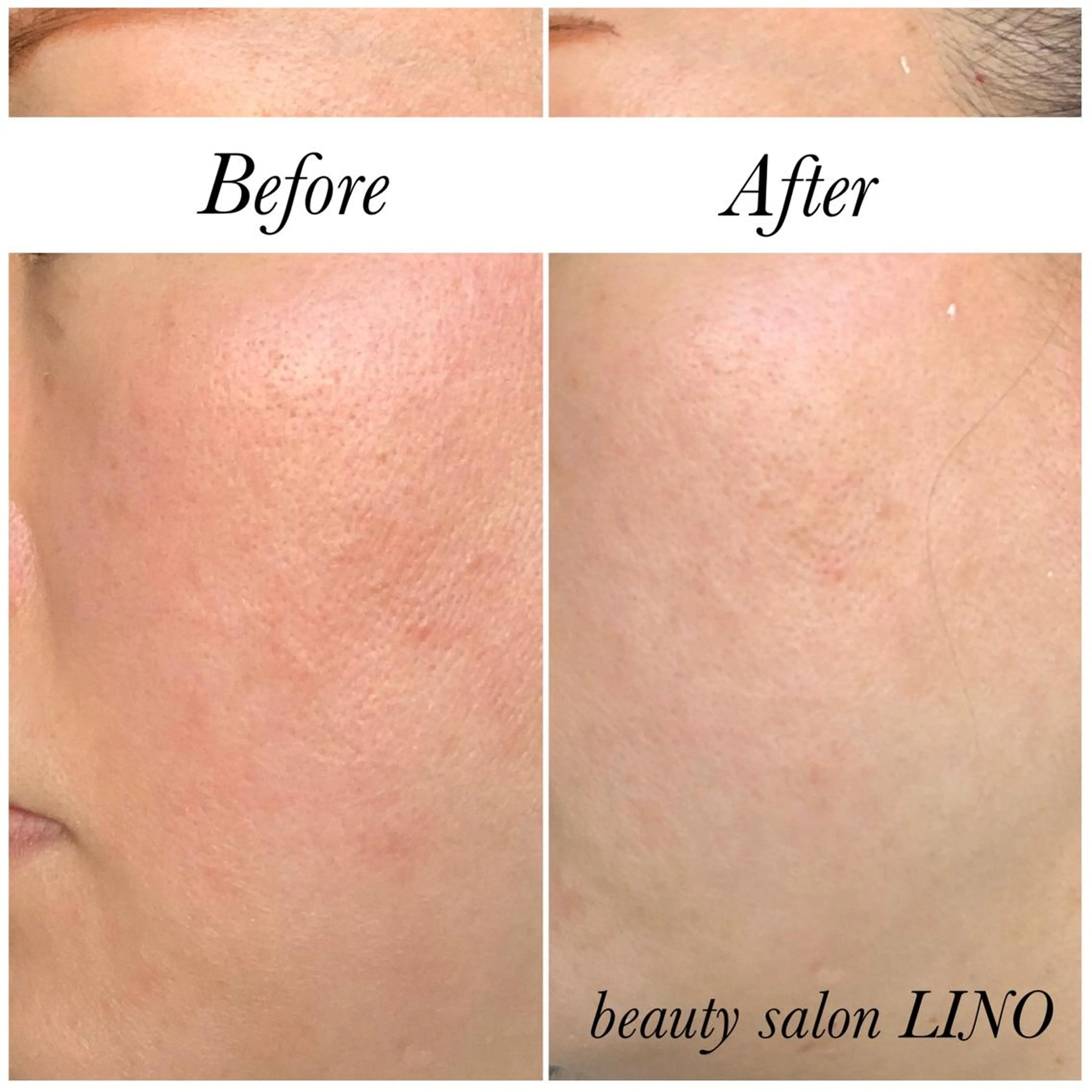 beautysalon  LINO所属・平日限定！お得！ 全メニュ¥5,500のエステ・リラクイメージ