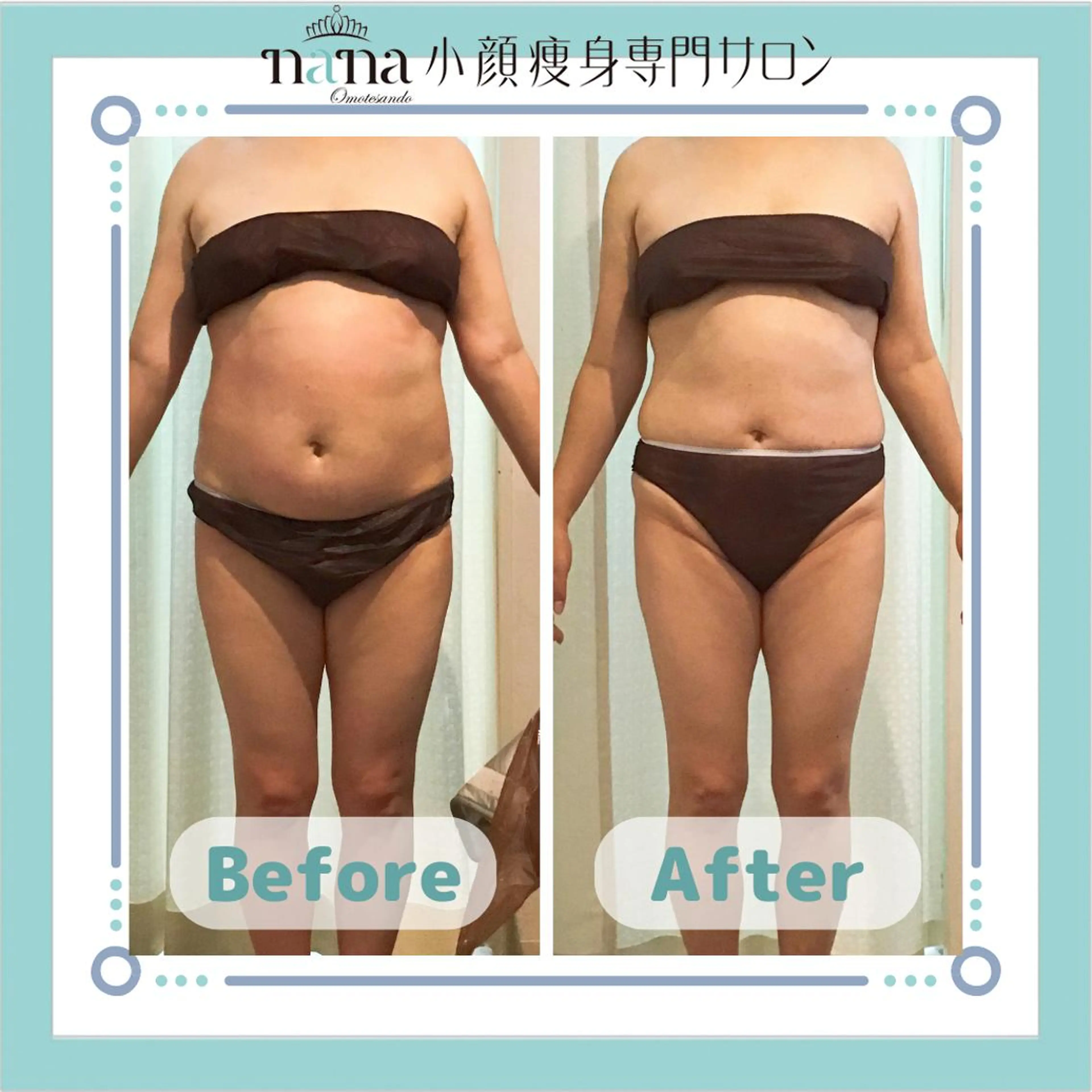 小顔痩身インディバ Nana表参道のエステ・リラクイメージ