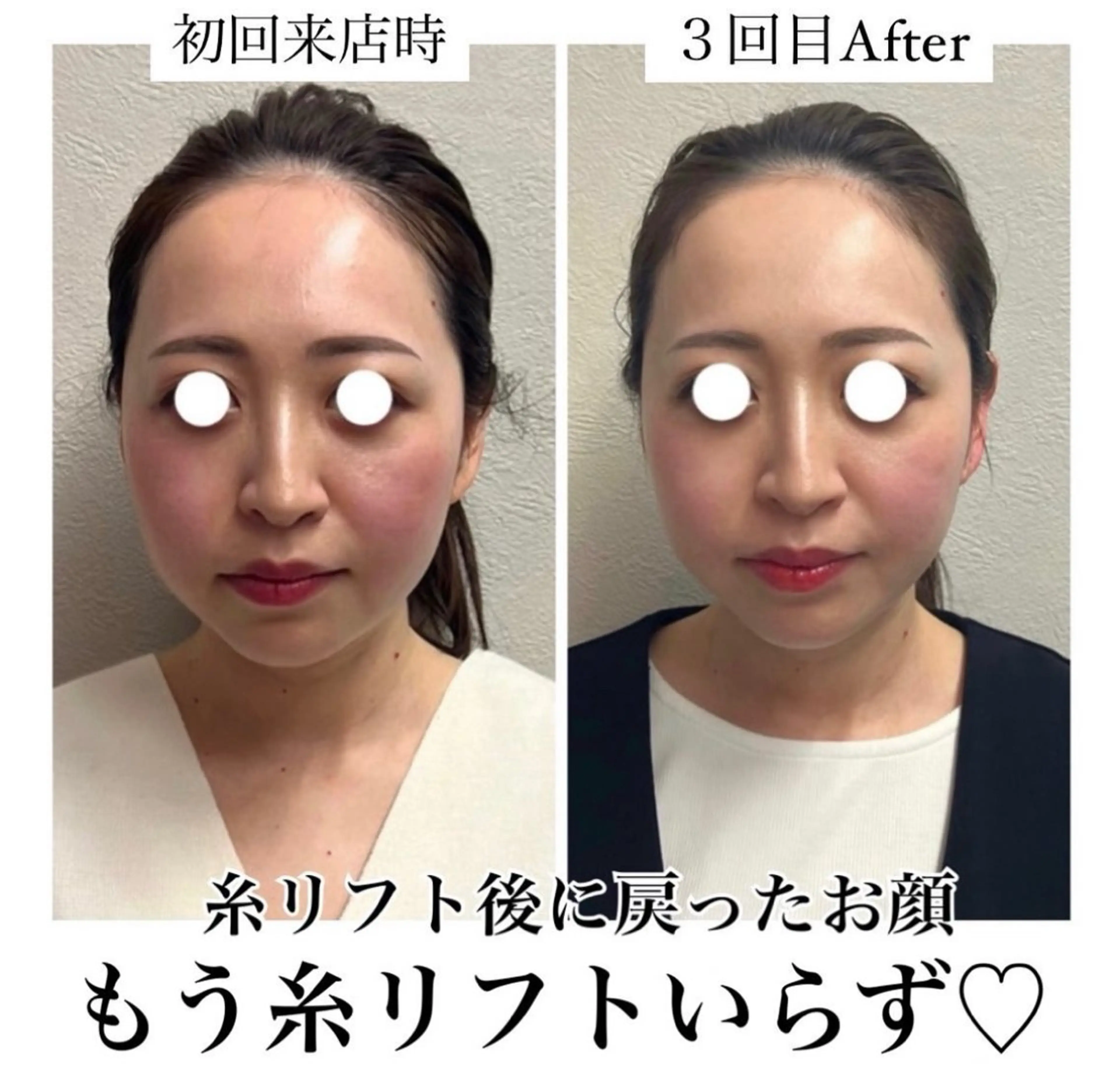 La　Beaute Verite所属・浅居 結菜のその他イメージ