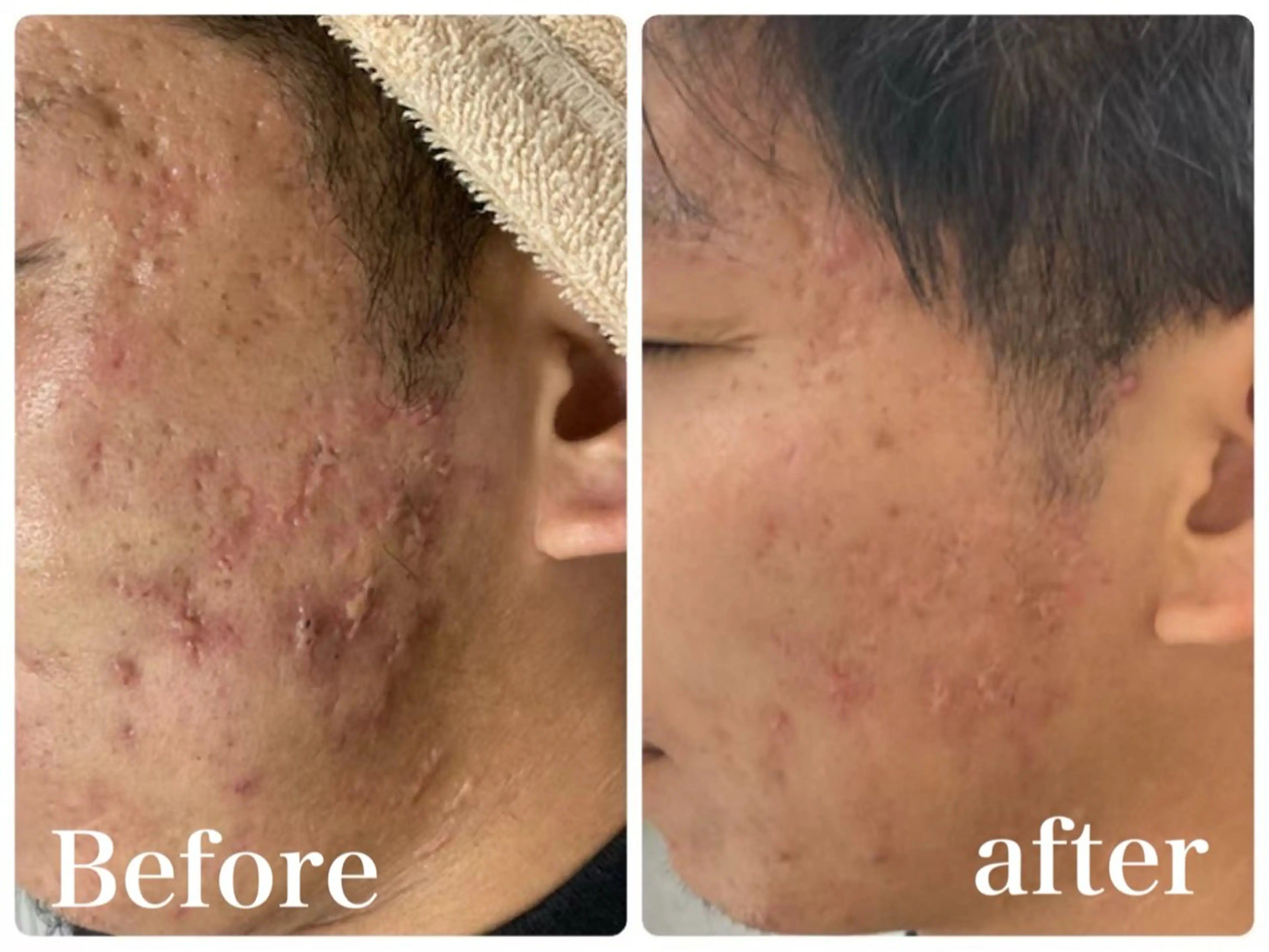 OOPARTS所属・大塚 杏美のエステ・リラクイメージ