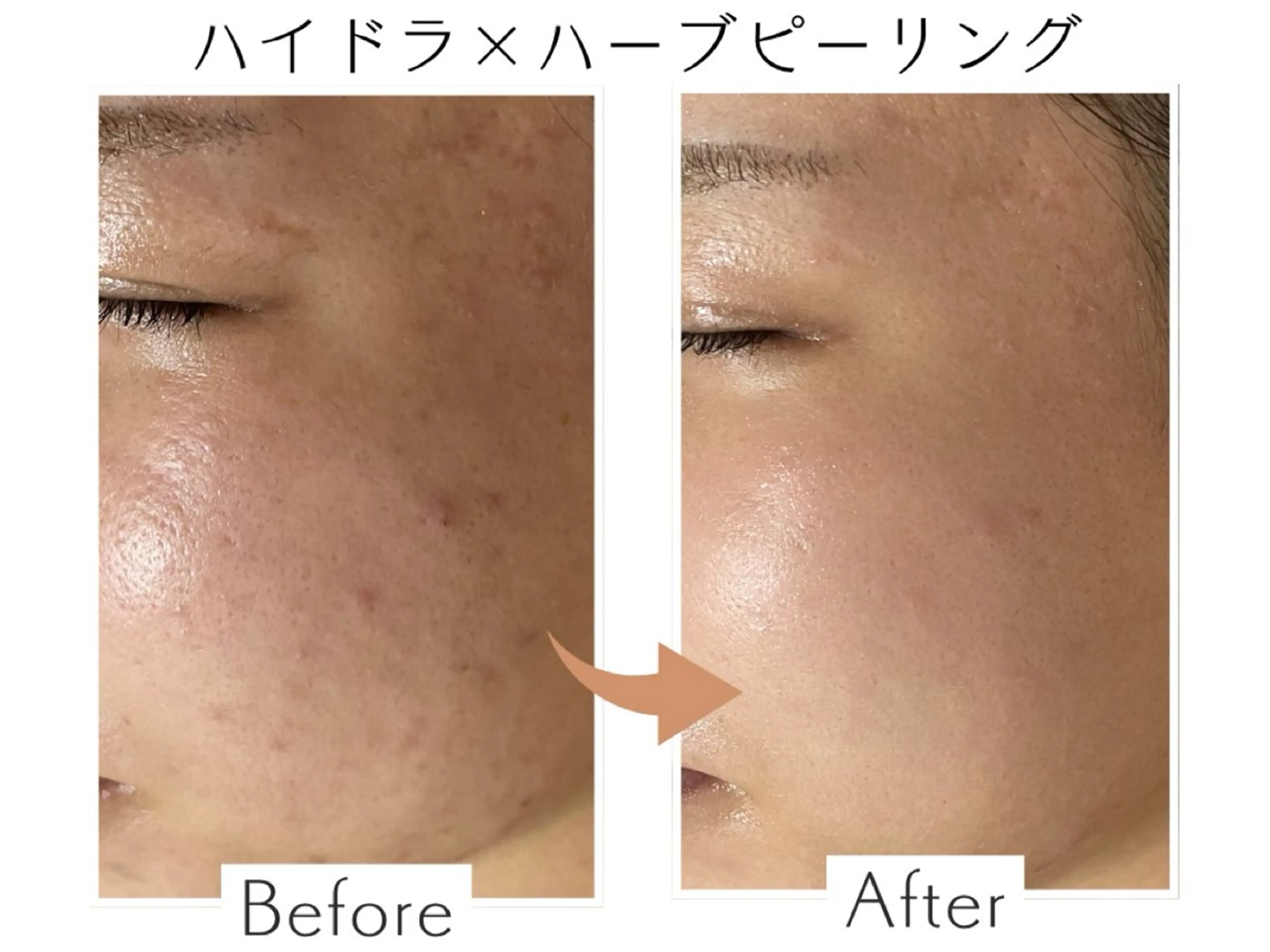 エステ プライベートサロン Belle（ベル）のエステ・リラクイメージ