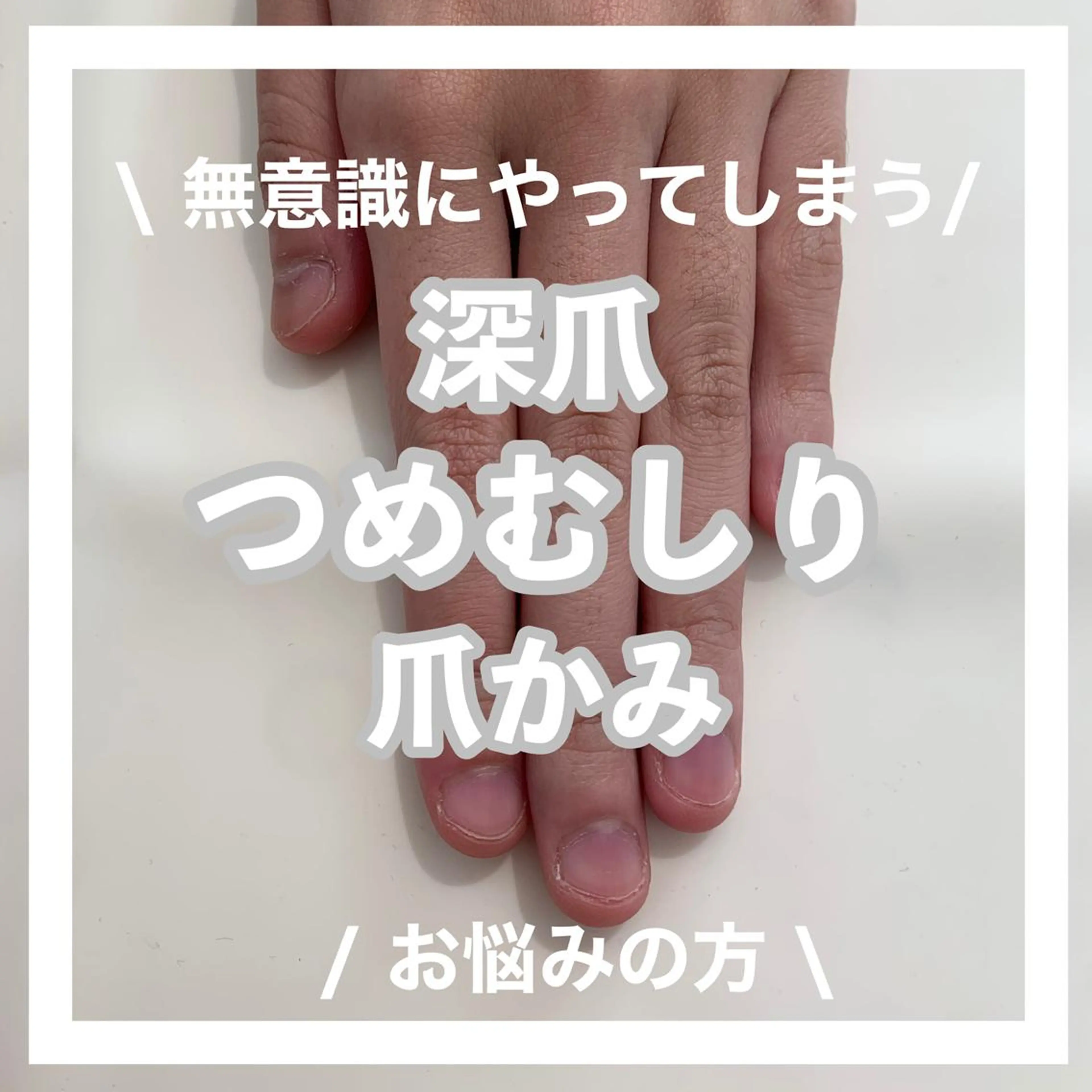 ネイル 毛穴改善/脱毛 ネイル 川上久仁子のエステ・リラクイメージ