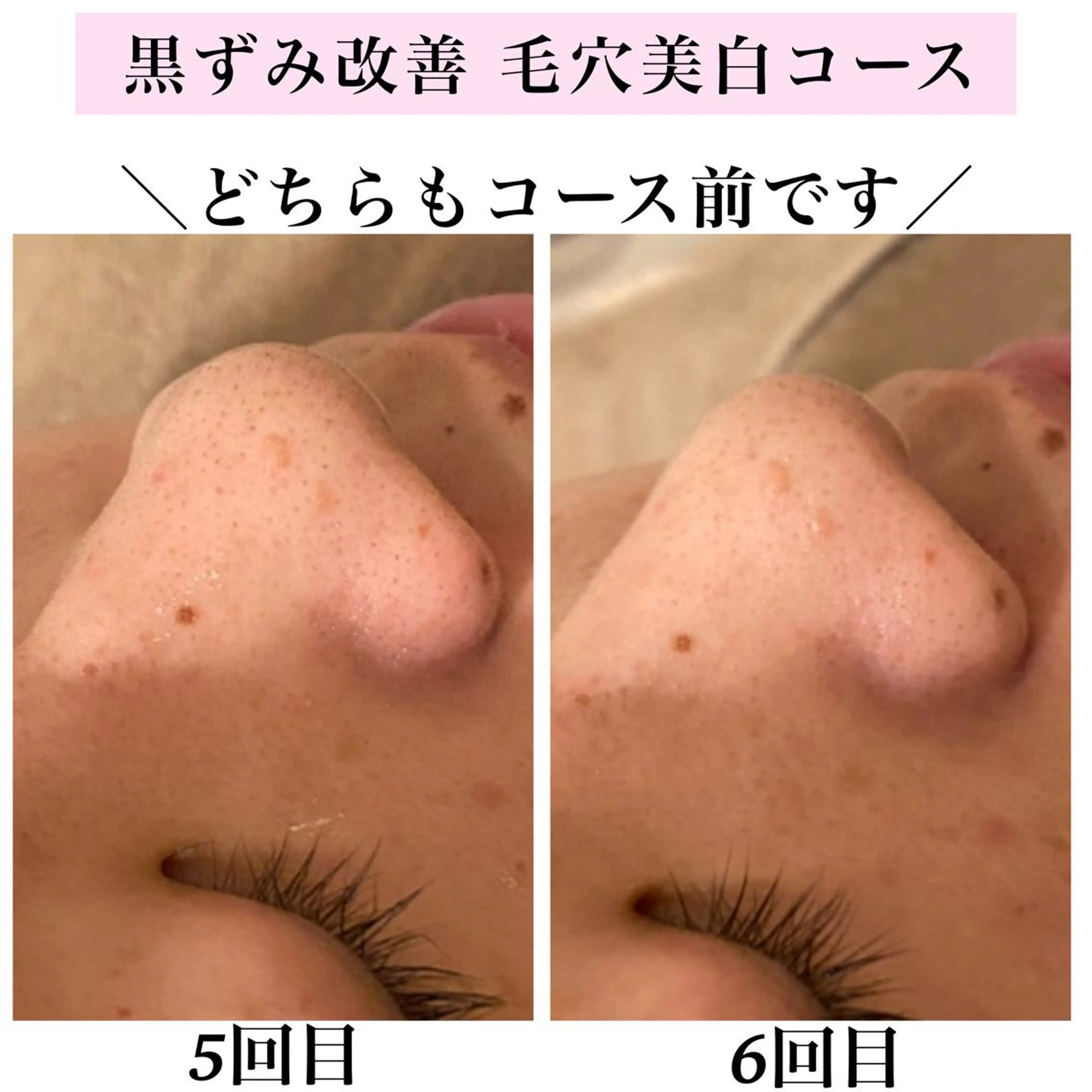 エステ リラク Bellesthe (ベルエステ)のエステ・リラクイメージ