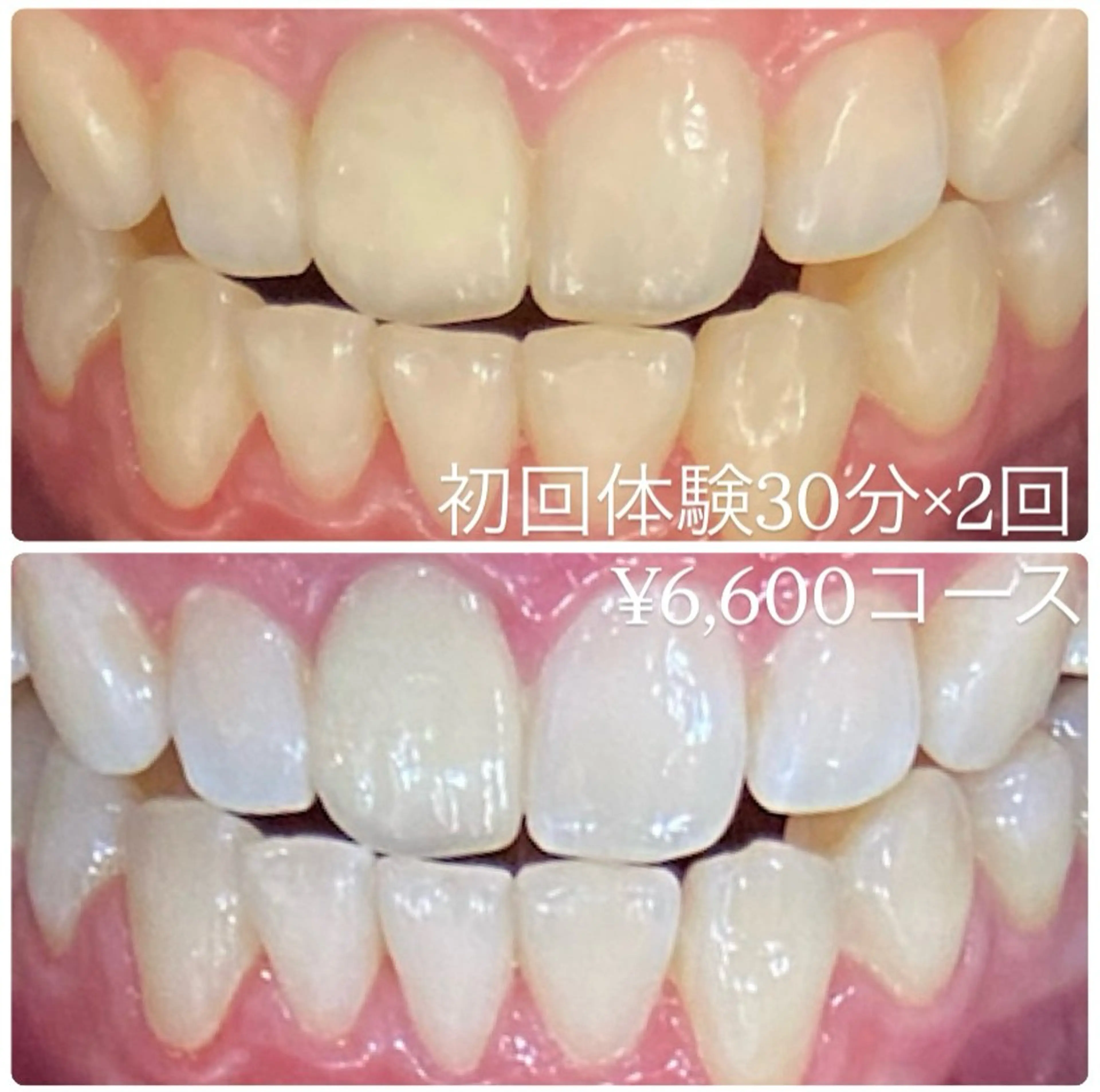 PLATINUM Beauty 横浜店所属・ホワイトニングルーム 横浜店のその他イメージ