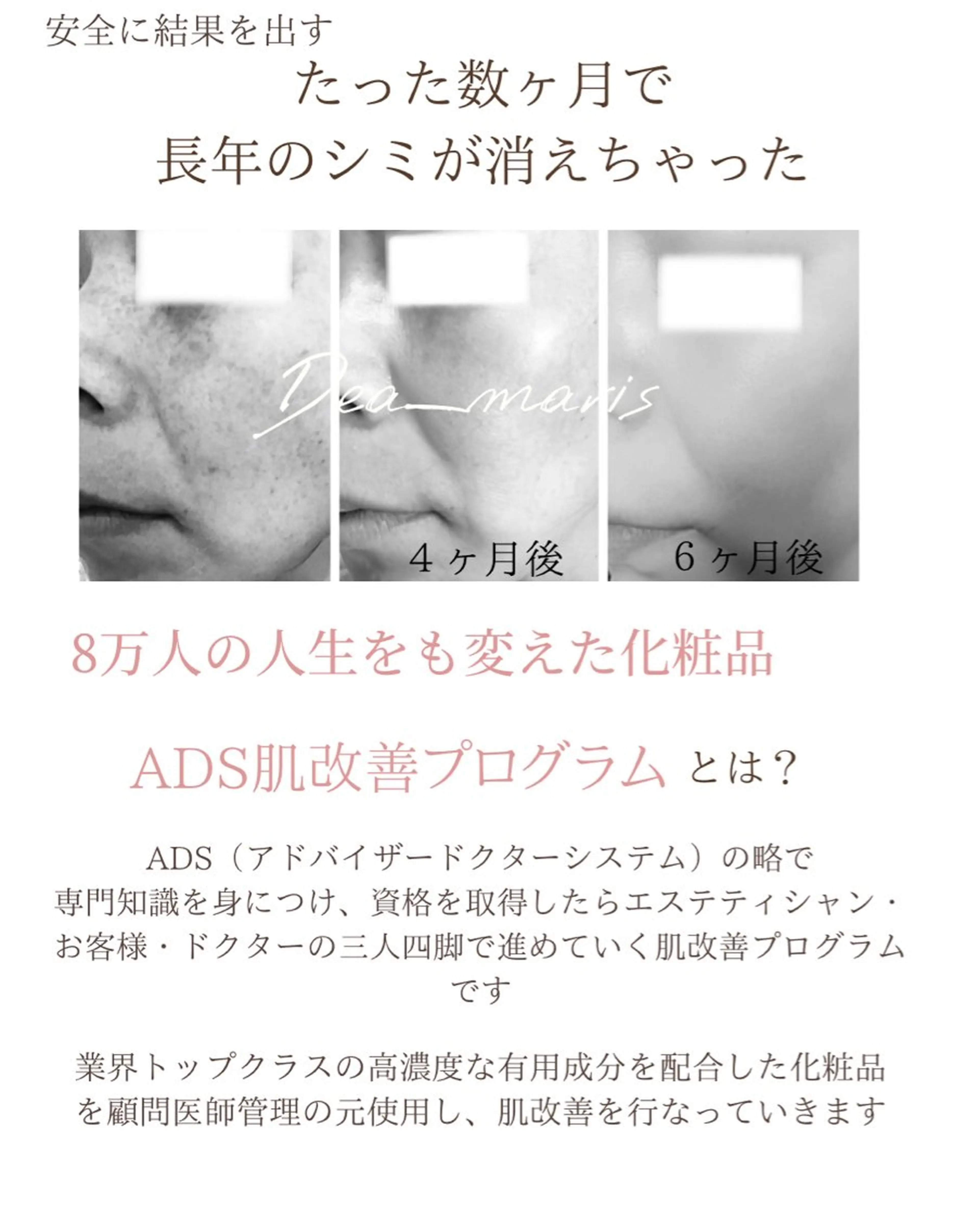 private salon  Dea_maris シュガーリング＆パーソナルボディケア所属・ダイエット難民が通う 10キロダイエットのその他イメージ
