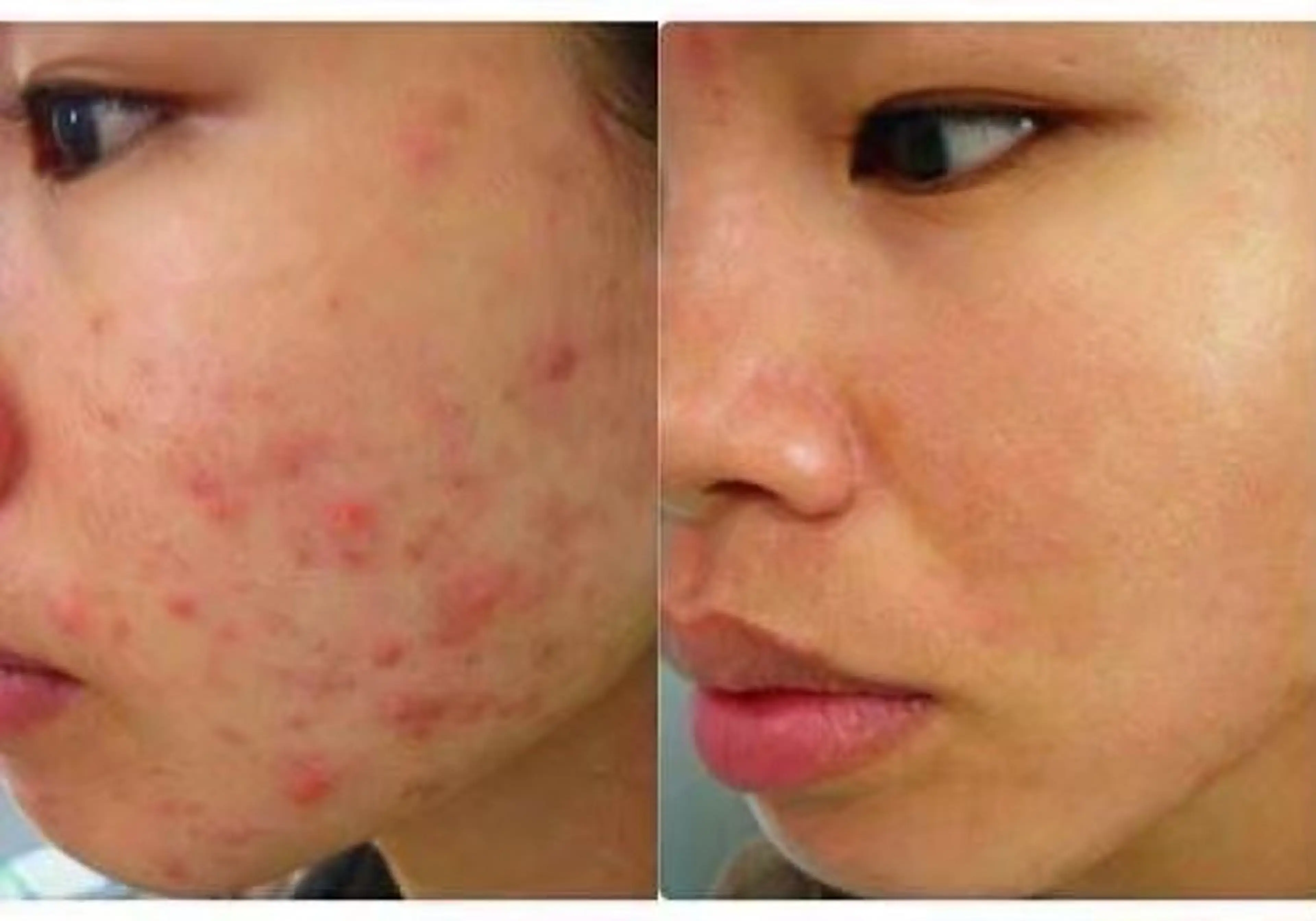 siro スタッフのエステ・リラクイメージ