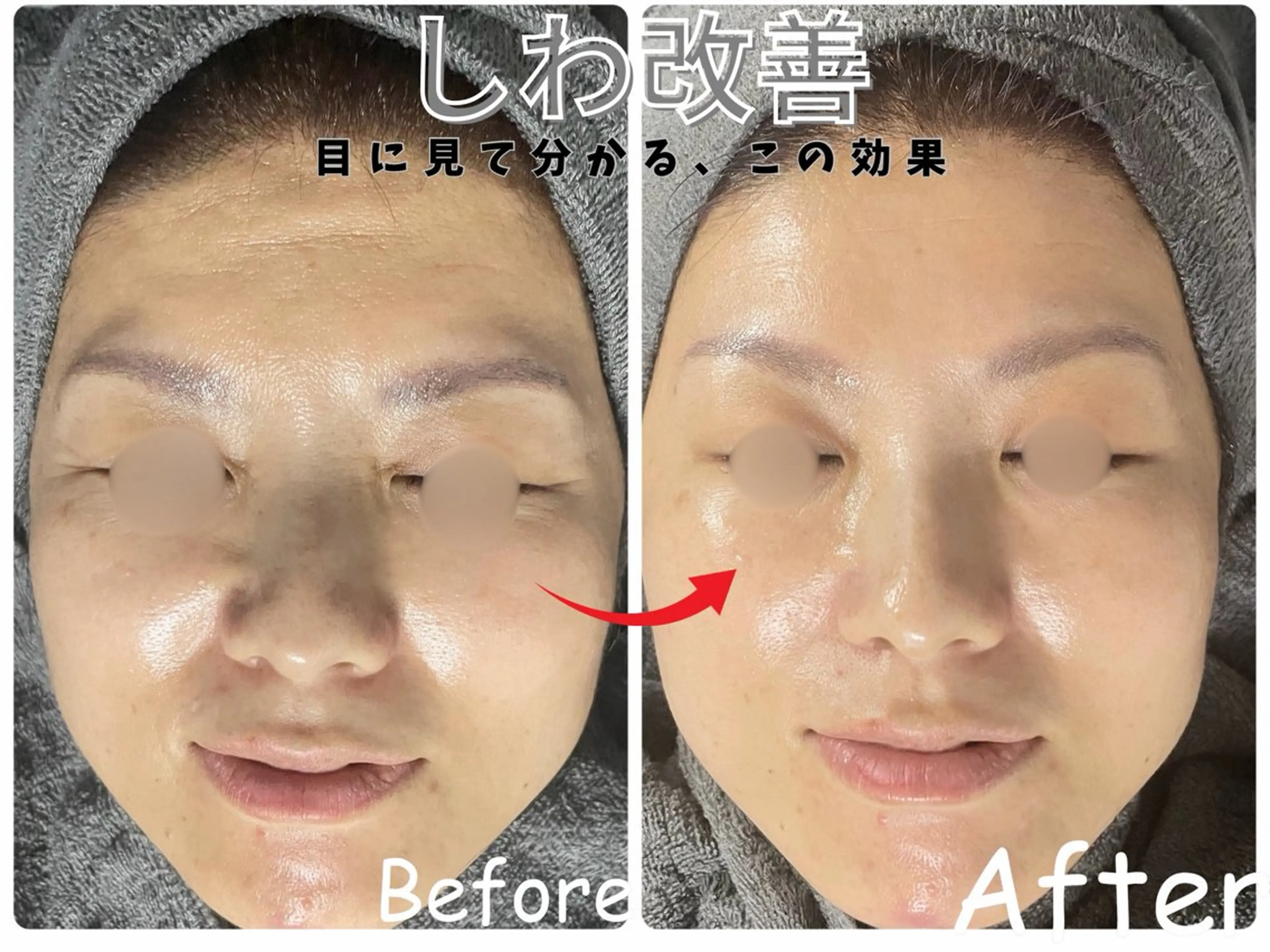 エステ リラク ele"ハーブ ピーリング 専門店のエステ・リラクイメージ