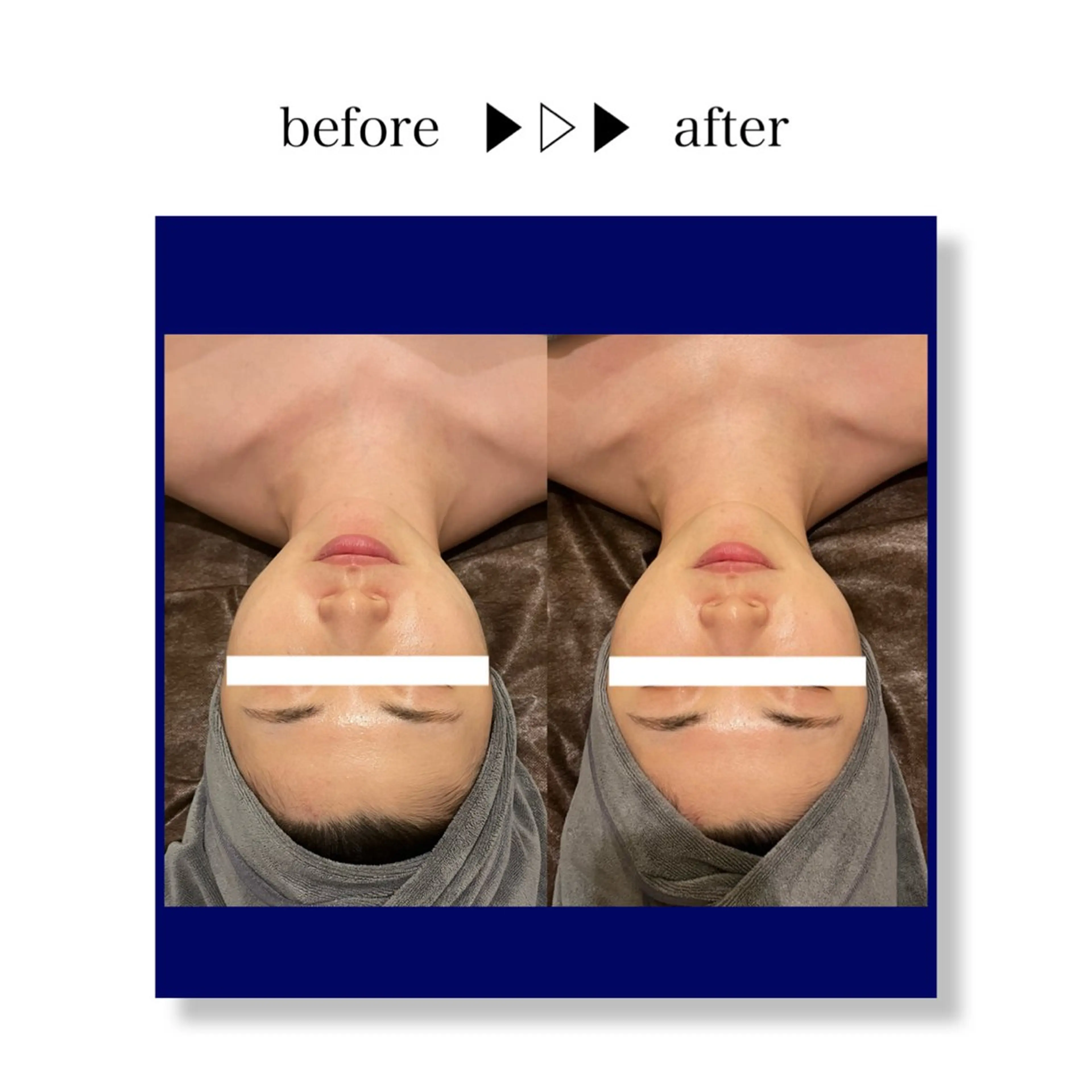 ☆痩身/小顔☆ 結果出します☆のエステ・リラクイメージ