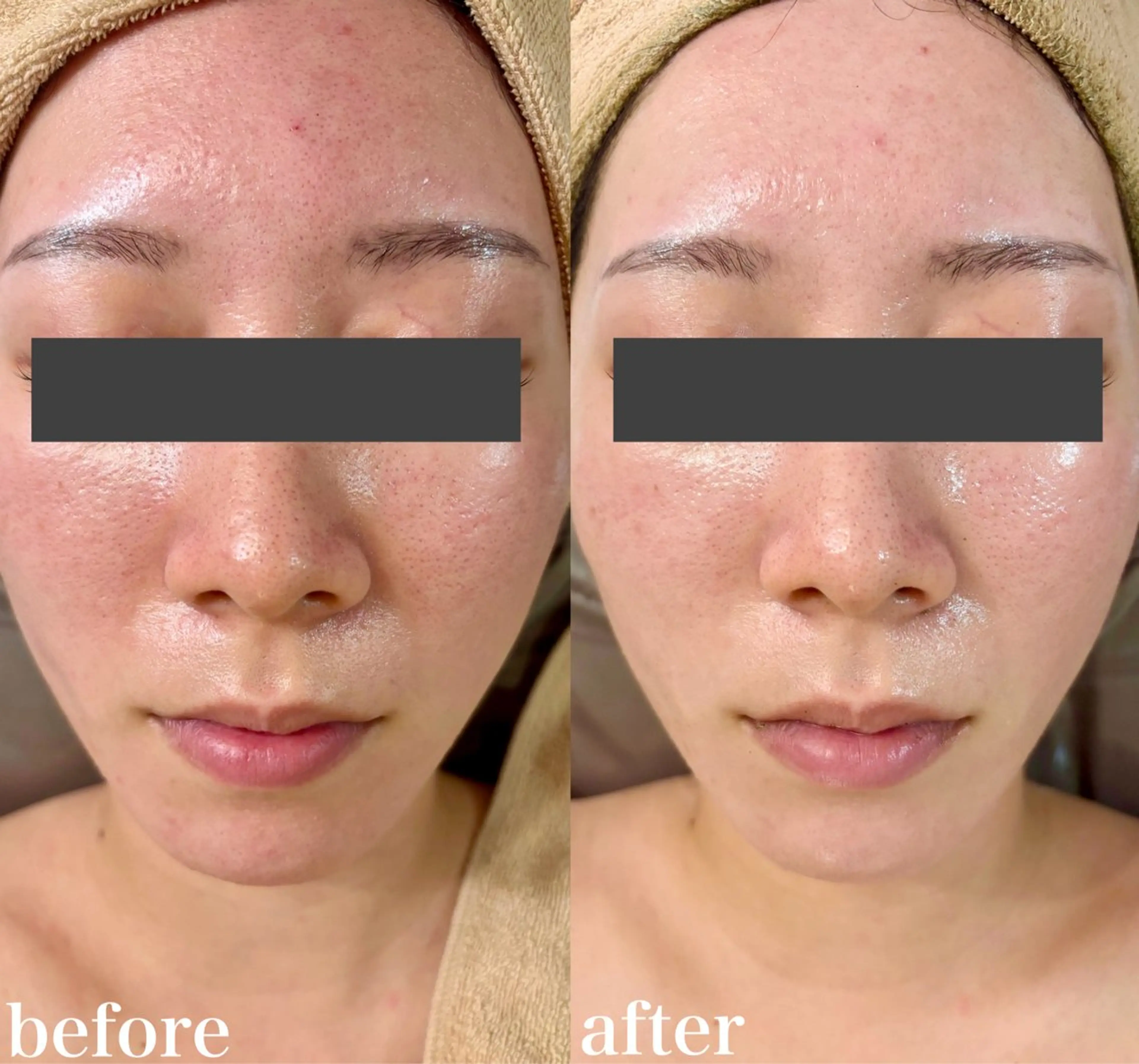 WHITE AQUA 北千住店のエステ・リラクイメージ