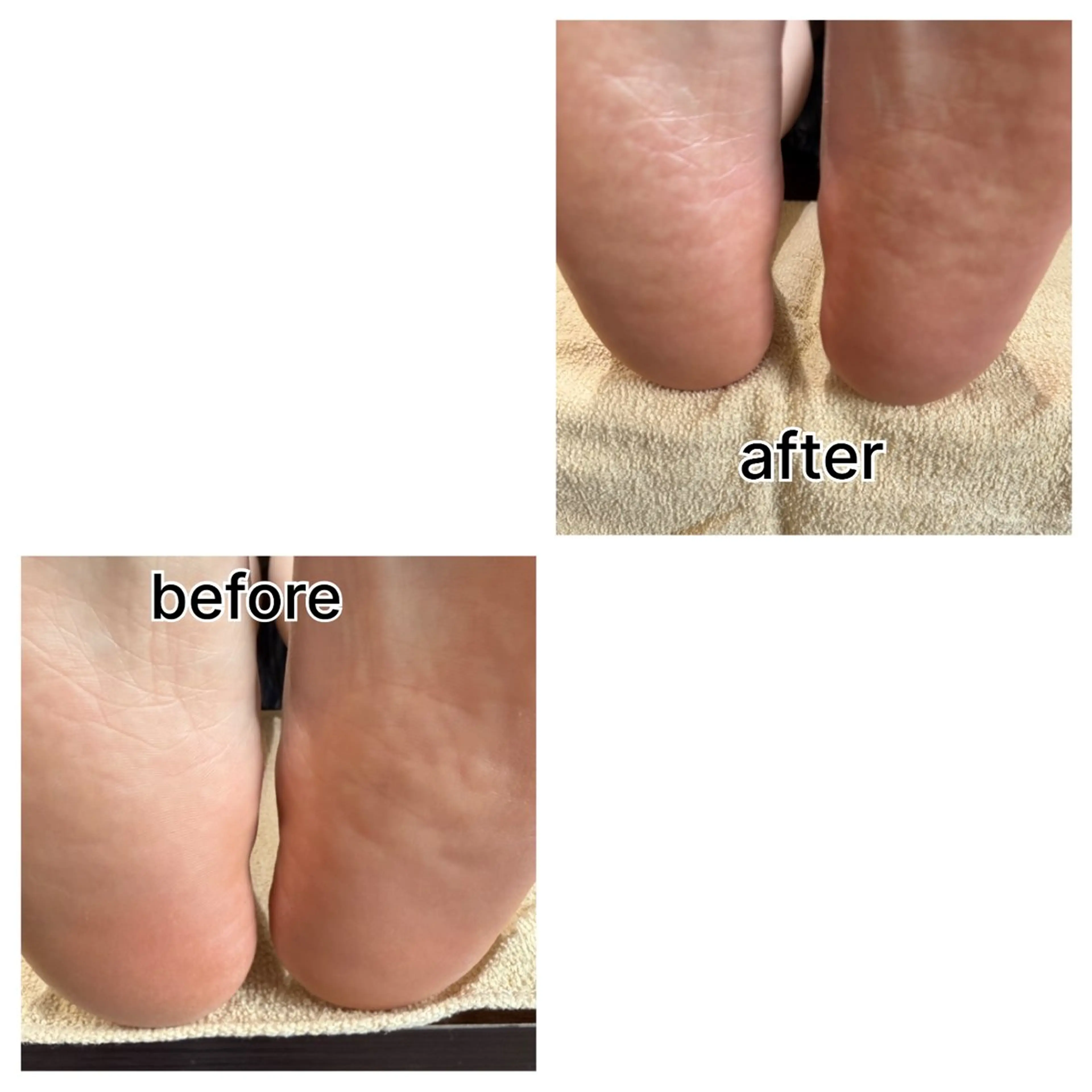 フットケアの写真