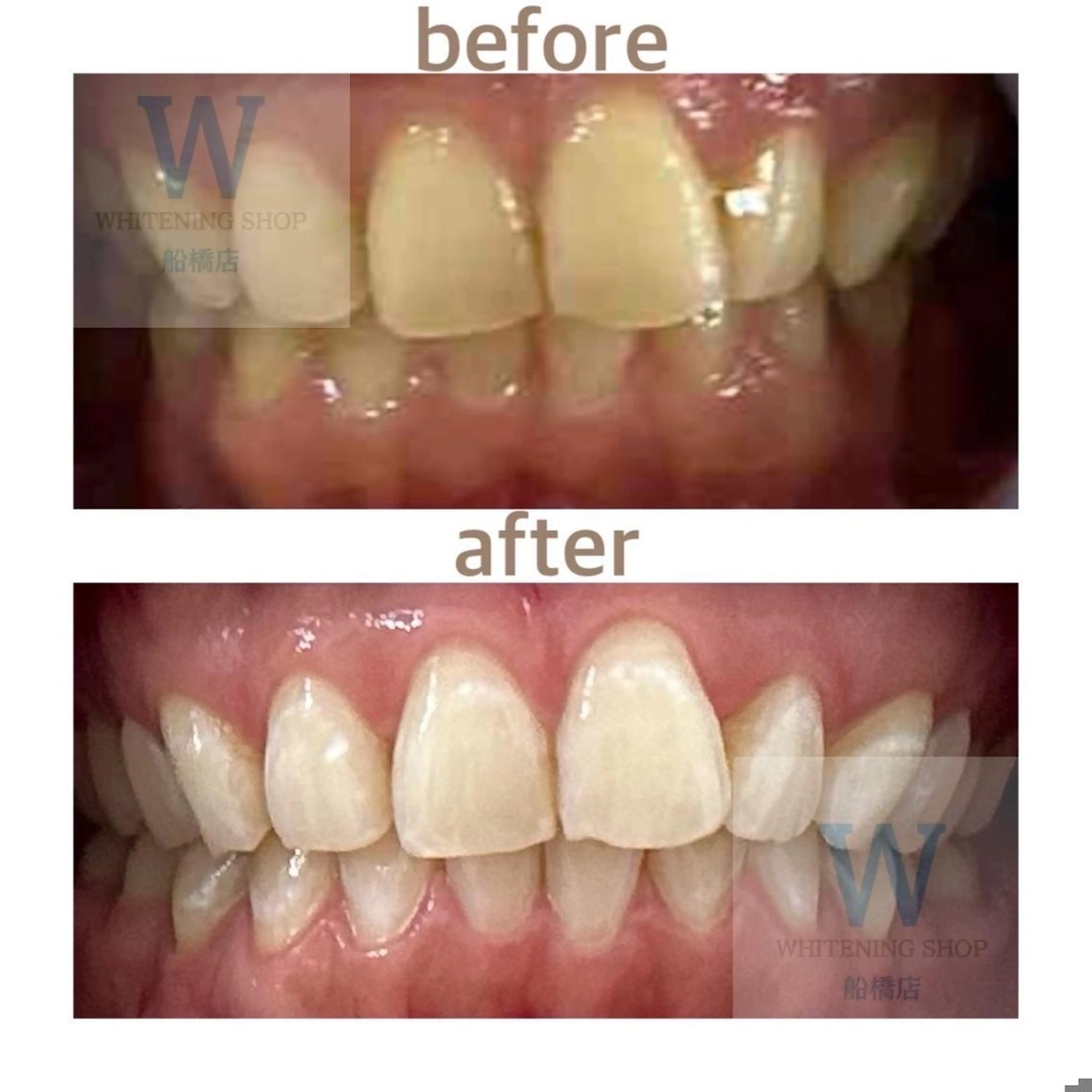 ホワイトニング ショップ船橋2号店のエステ・リラクイメージ