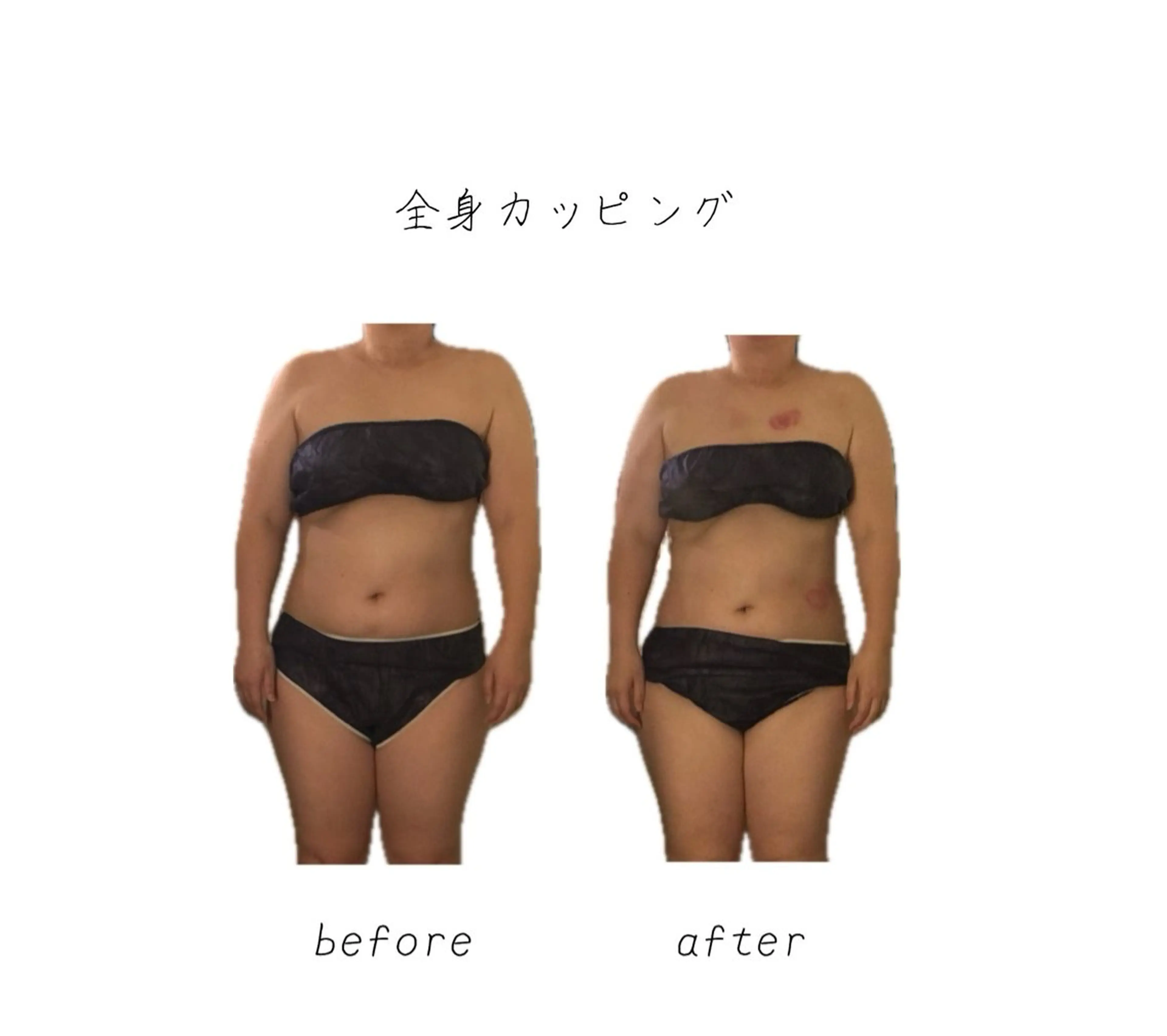 その他 小顔コルギ専門店/隠れ家サロン《여름ヨルム》所属・小顔コルギ専門店 《ヨルム》龍ケ崎店のエステ・リラクイメージ