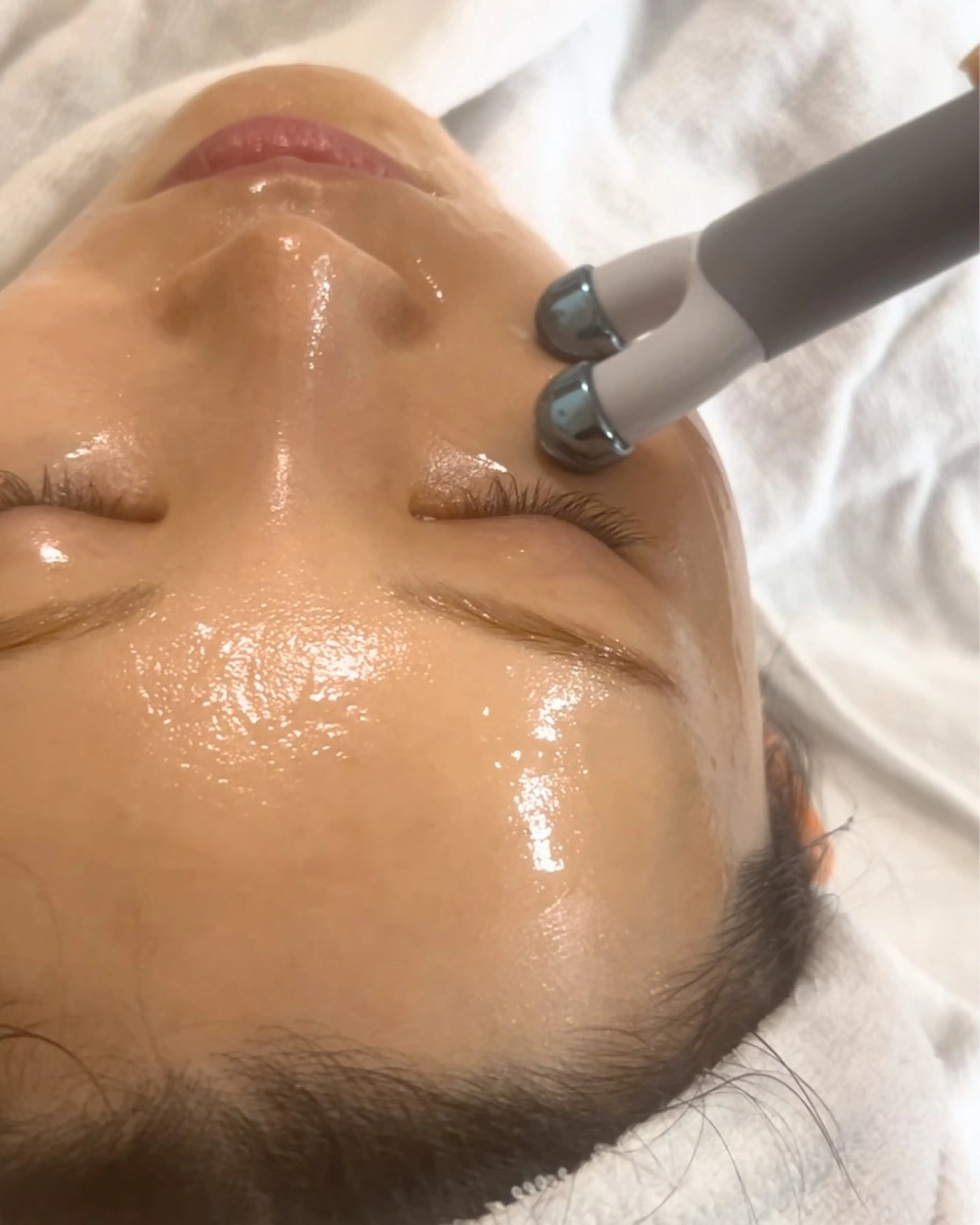 【プルプル肌に★針を使わずに深層浸透】ポレーションエステ（お悩みに合わせたパック付き）の写真