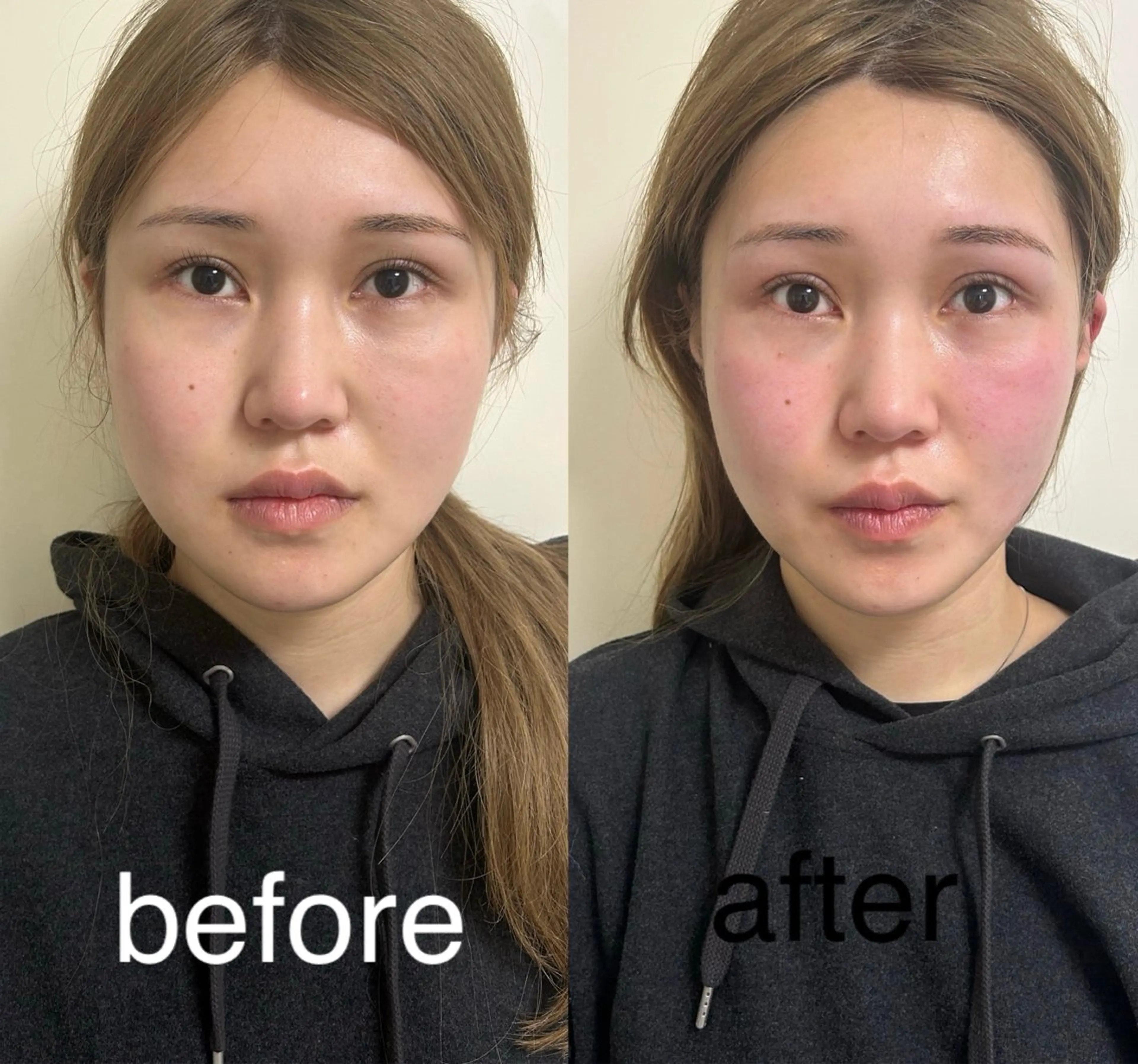 美容鍼灸サロン mahoroba院長のエステ・リラクイメージ