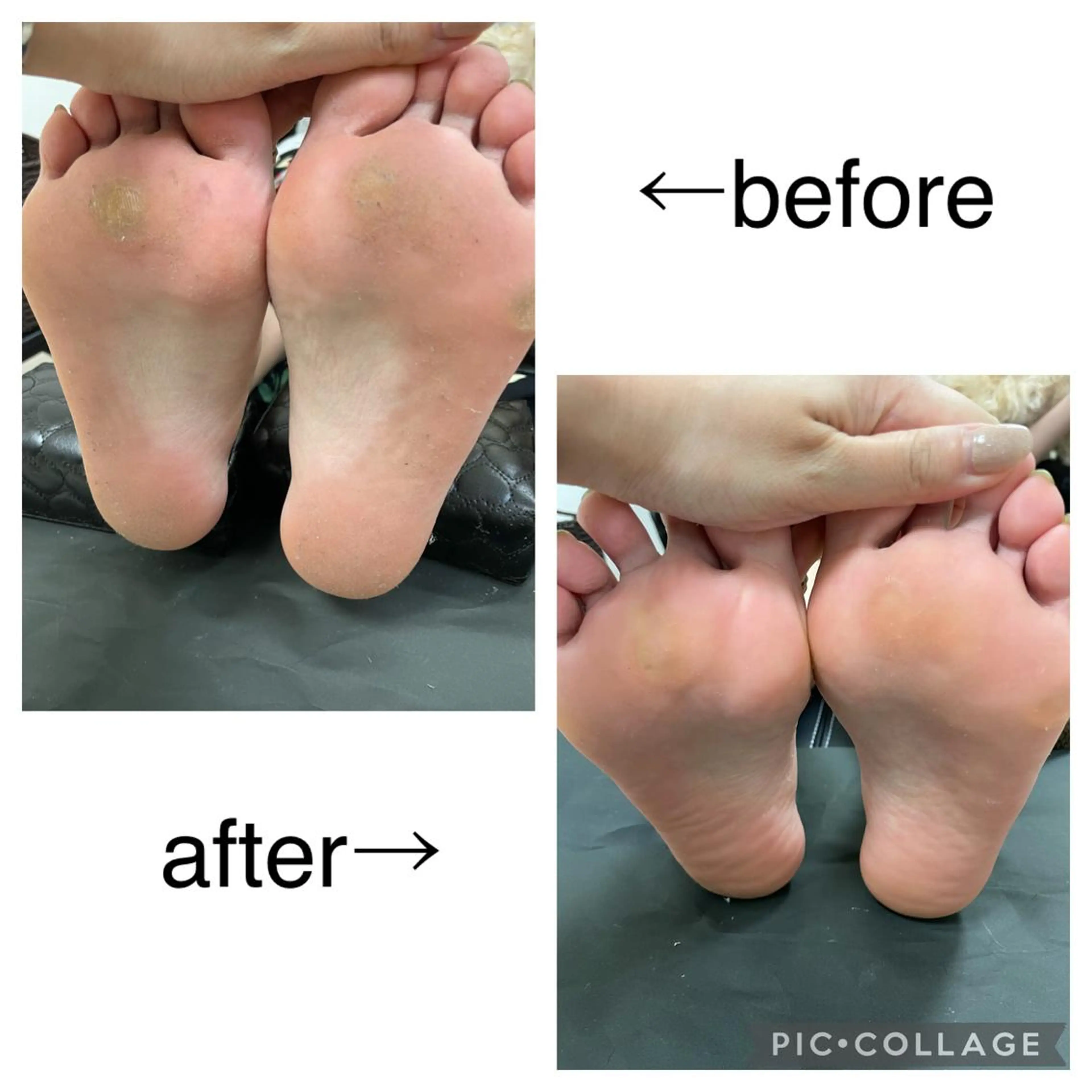 ネイル フットネイル Minaminail やり放題ネイル🍓のネイルデザイン