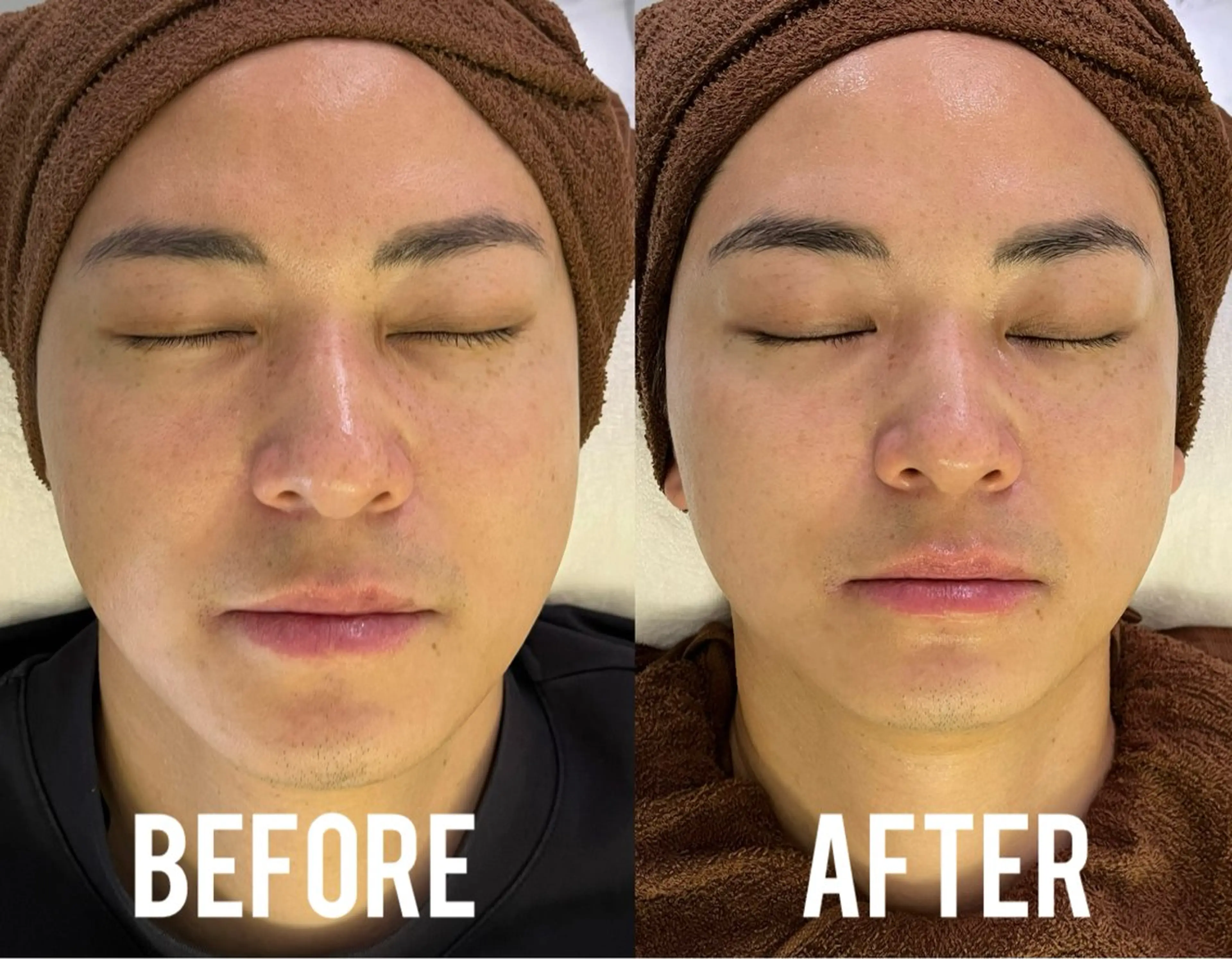 エステ MEITY新宿所属・小顔、毛穴ケア MEITY新宿のエステ・リラクイメージ