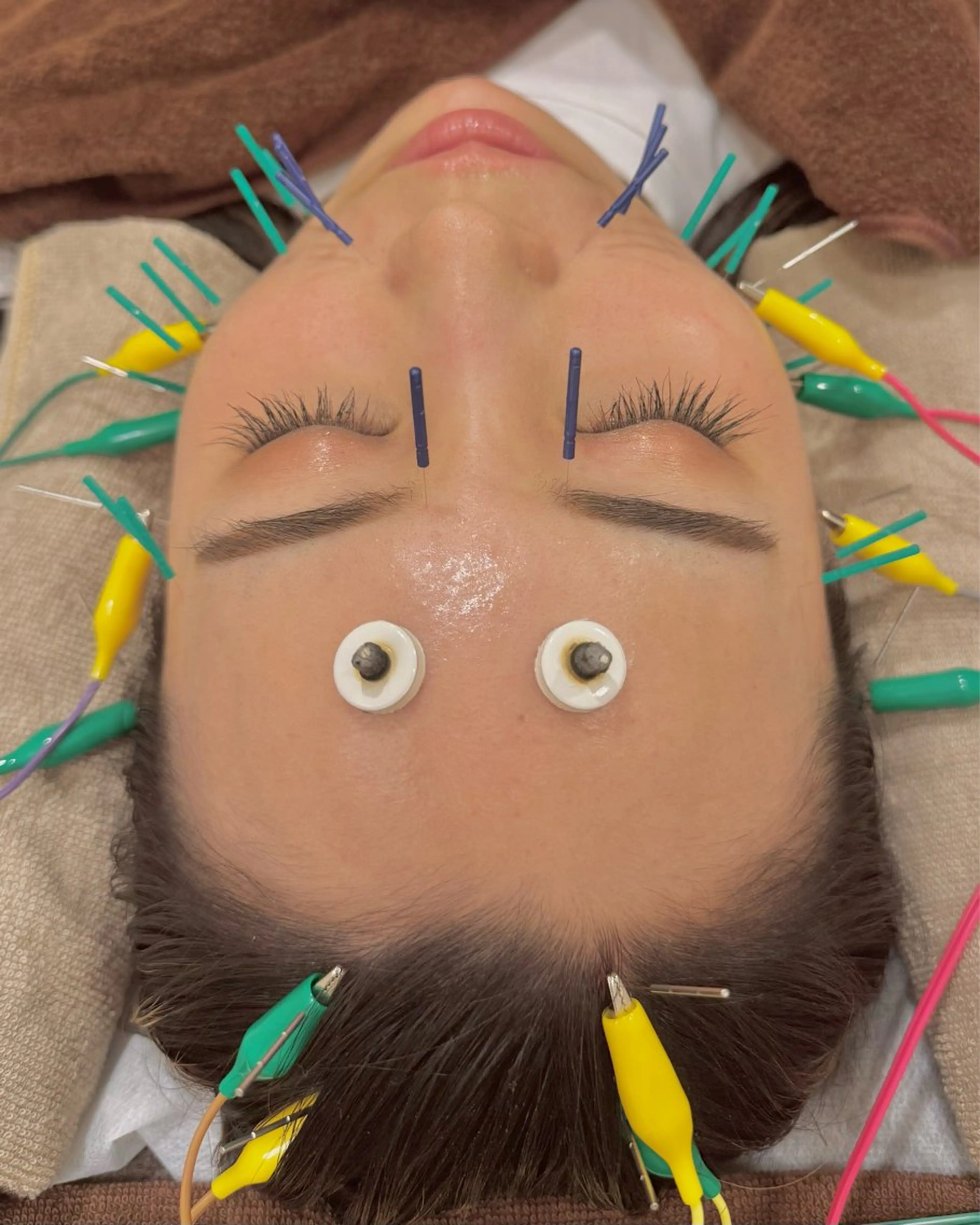 エステ Ayaka🤍 恵比寿/美容鍼/整体のエステ・リラクイメージ