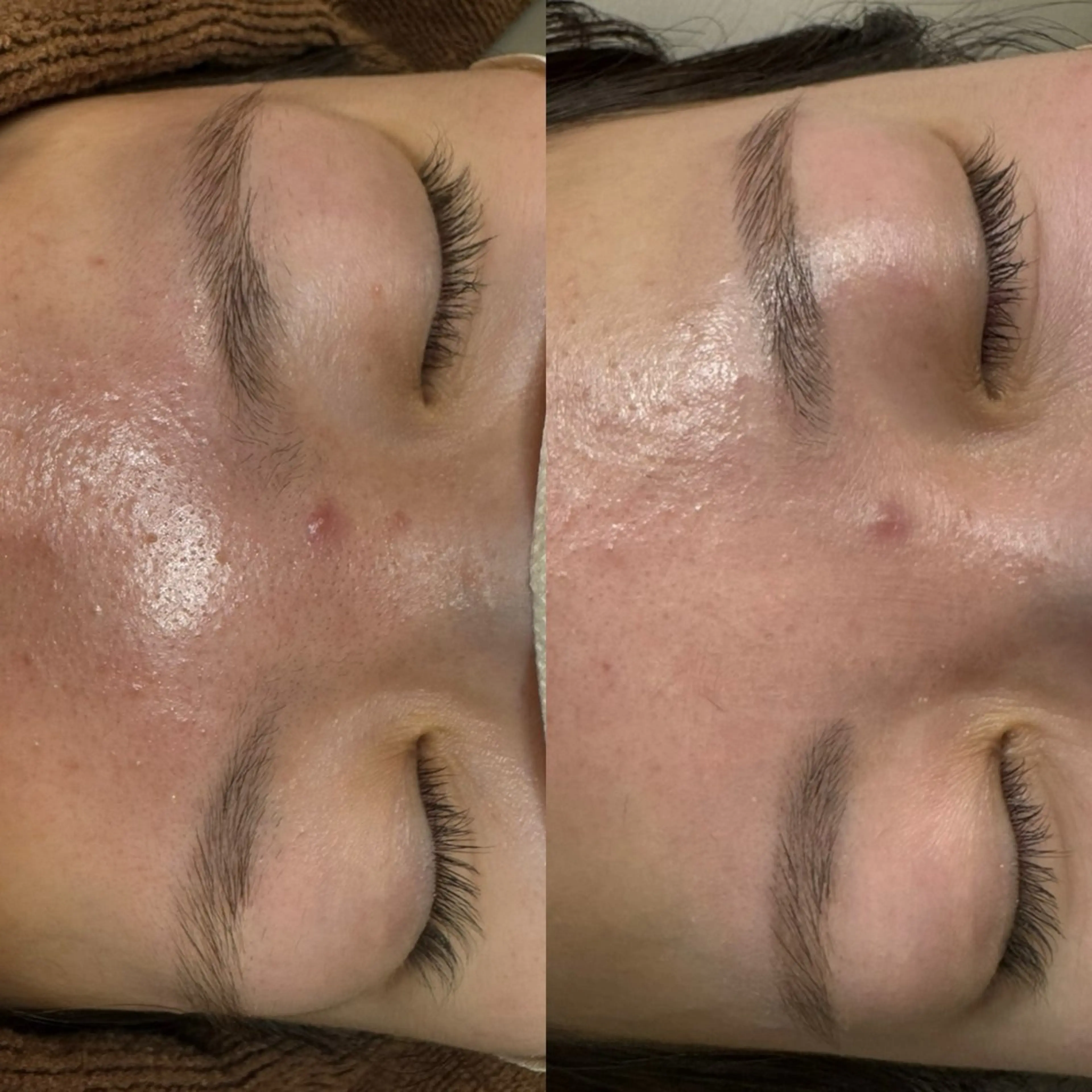 アイブロウ その他(アイブロウ) salonvilla所属・villa ☺︎草山 楓花のエステ・リラクイメージ