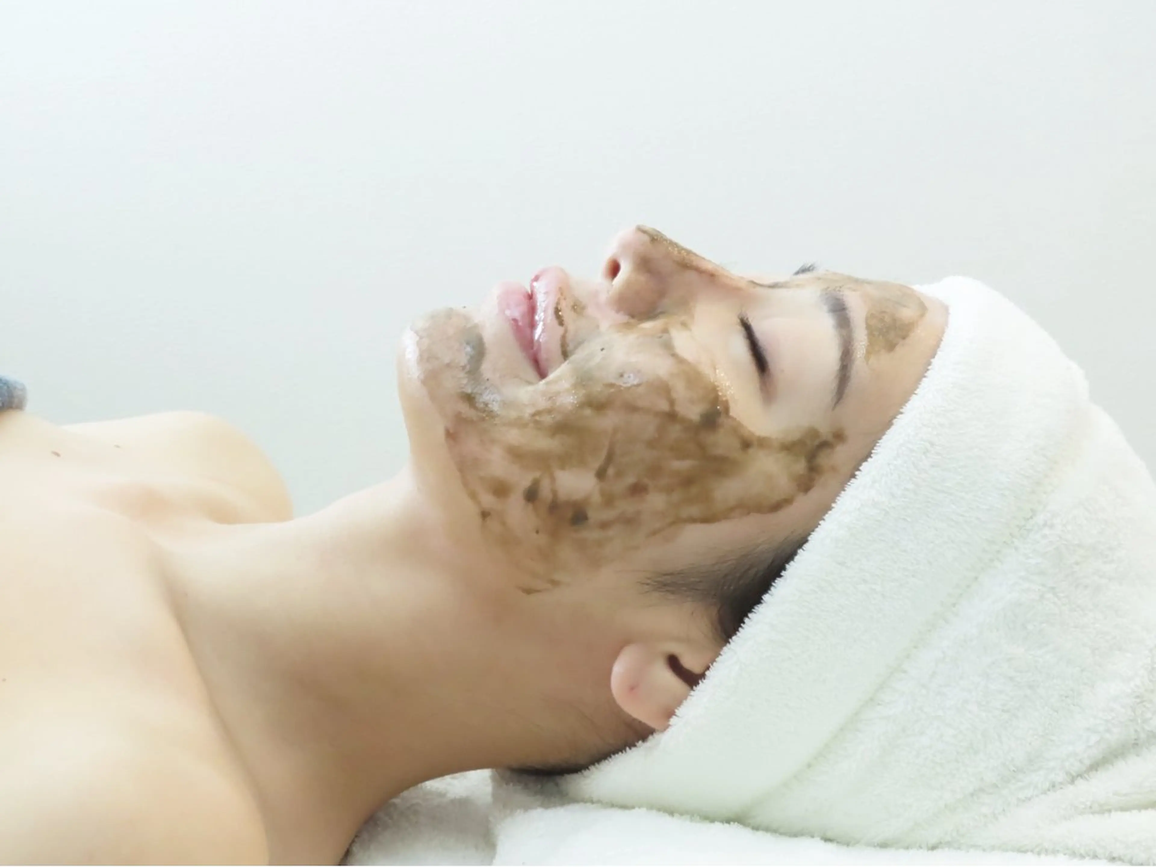 剥離あり最新針入りハーブピーリング🌿の写真