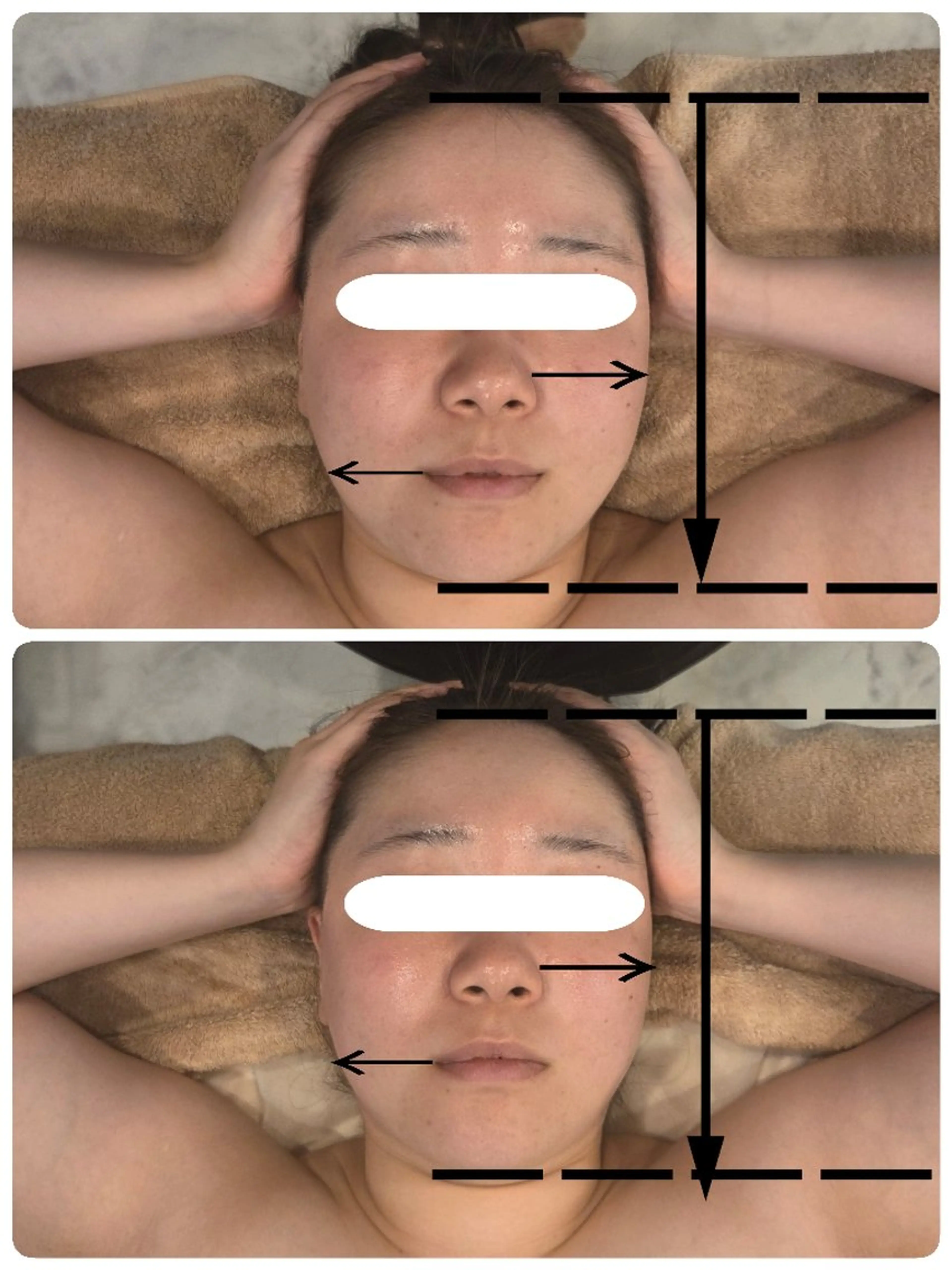 フェイシャルケア美容液導入込の写真