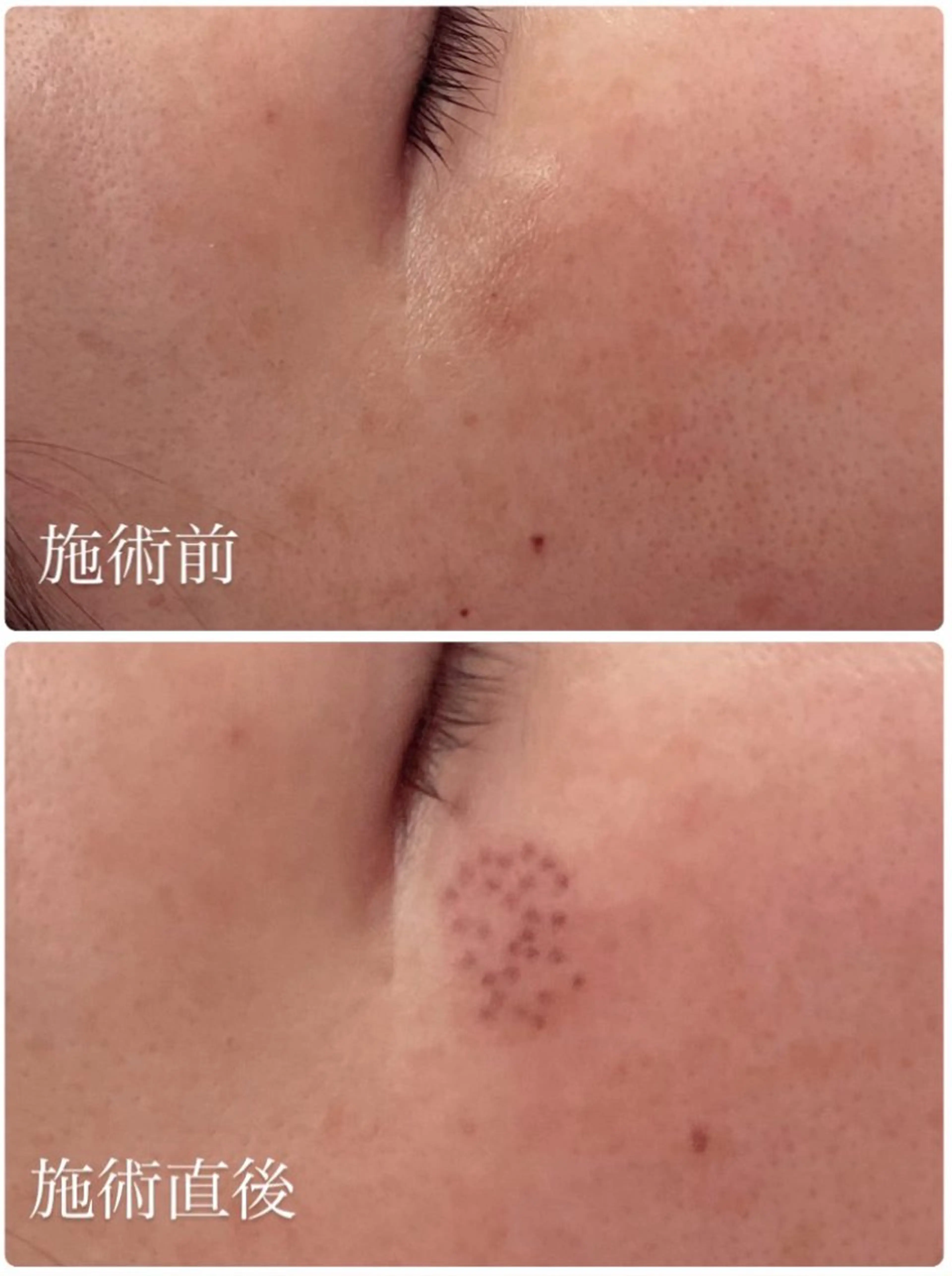 エステ emiluka beautyのエステ・リラクイメージ