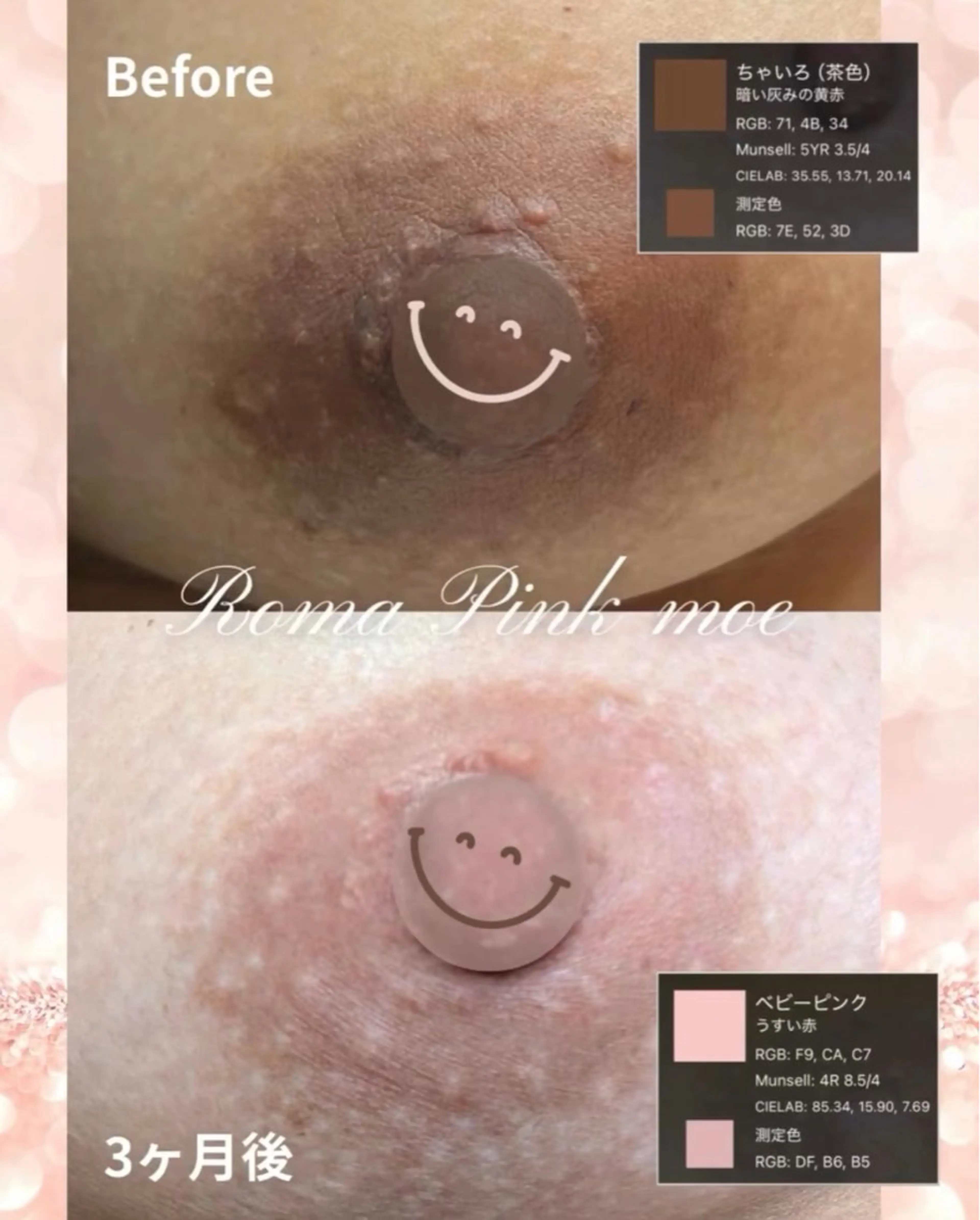 エステサロン-mignon-所属・mignon 脱毛/ ローマピンク/耳ツボのその他イメージ