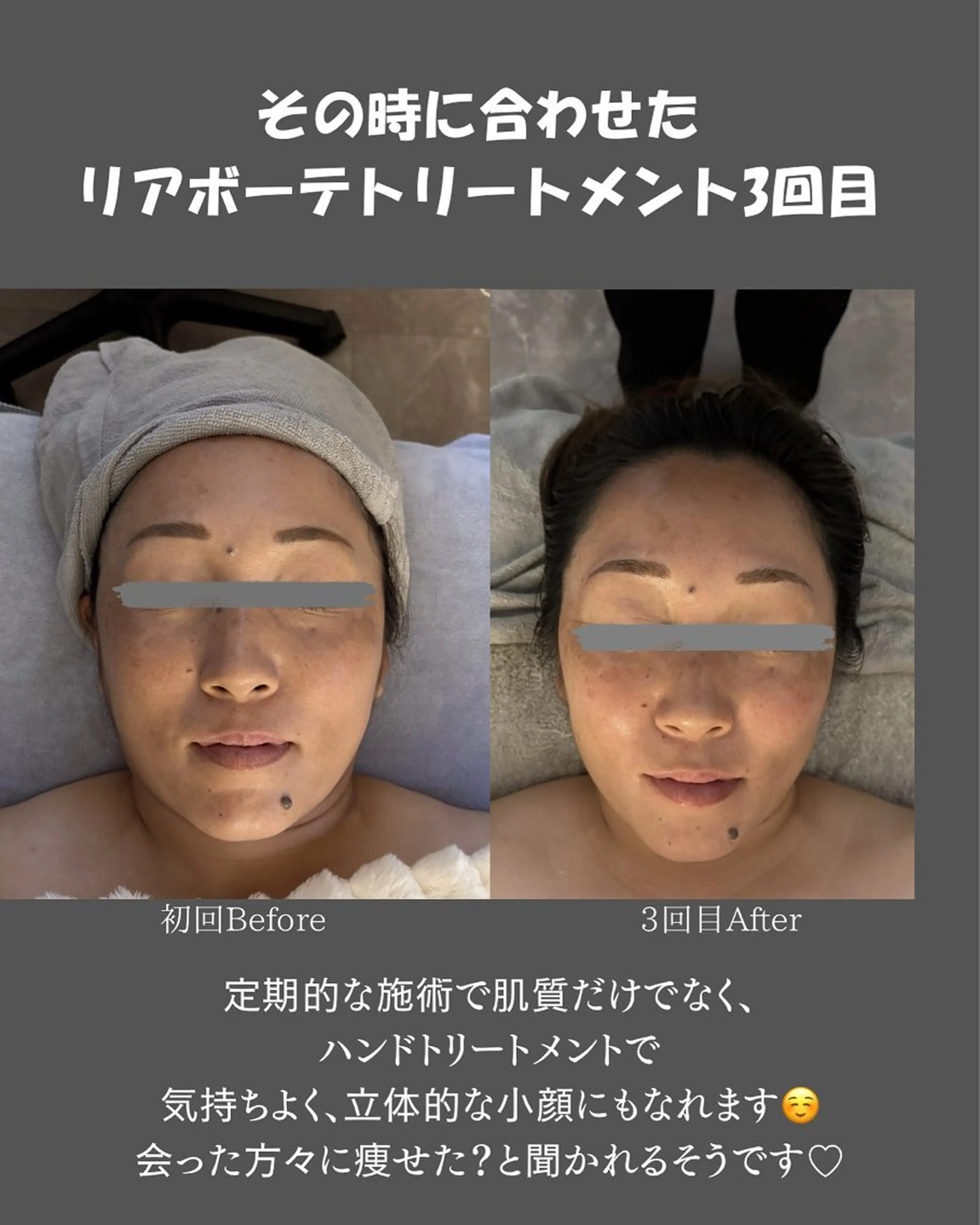 BLOSSOM 菊地のエステ・リラクイメージ