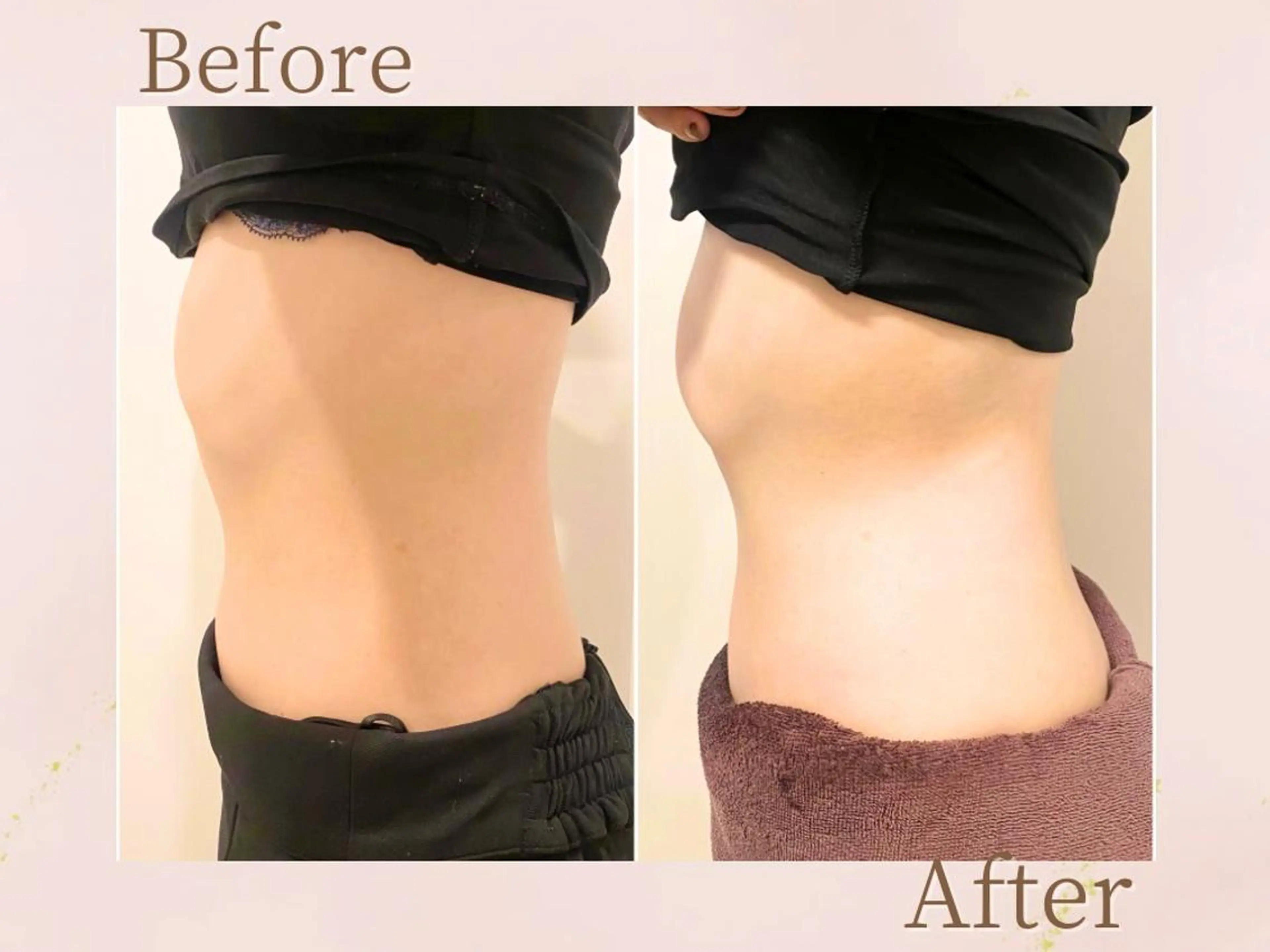 エステ 森近 美優のエステ・リラクイメージ