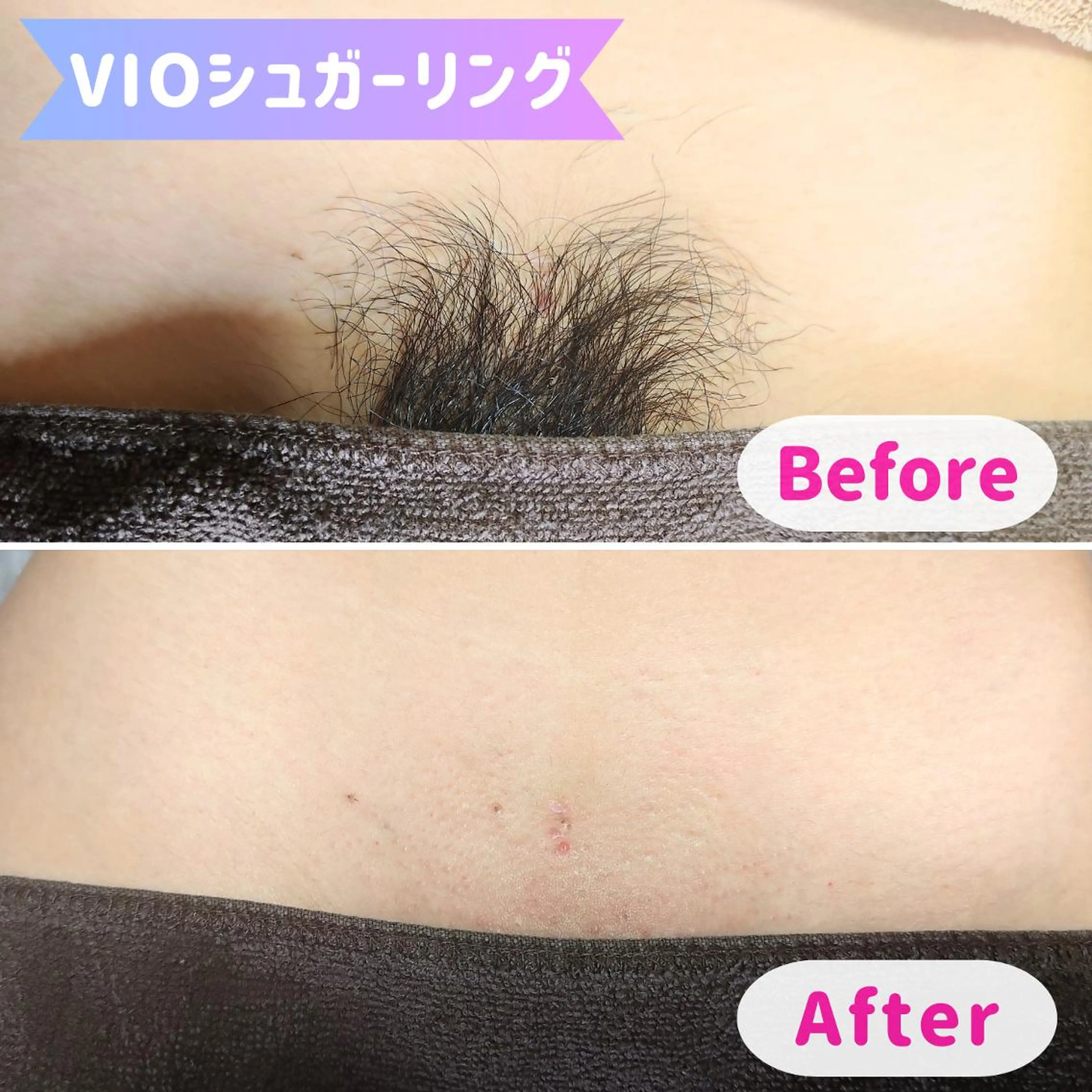 脱毛 SUCRE銀座 ヤマグチのエステ・リラクイメージ