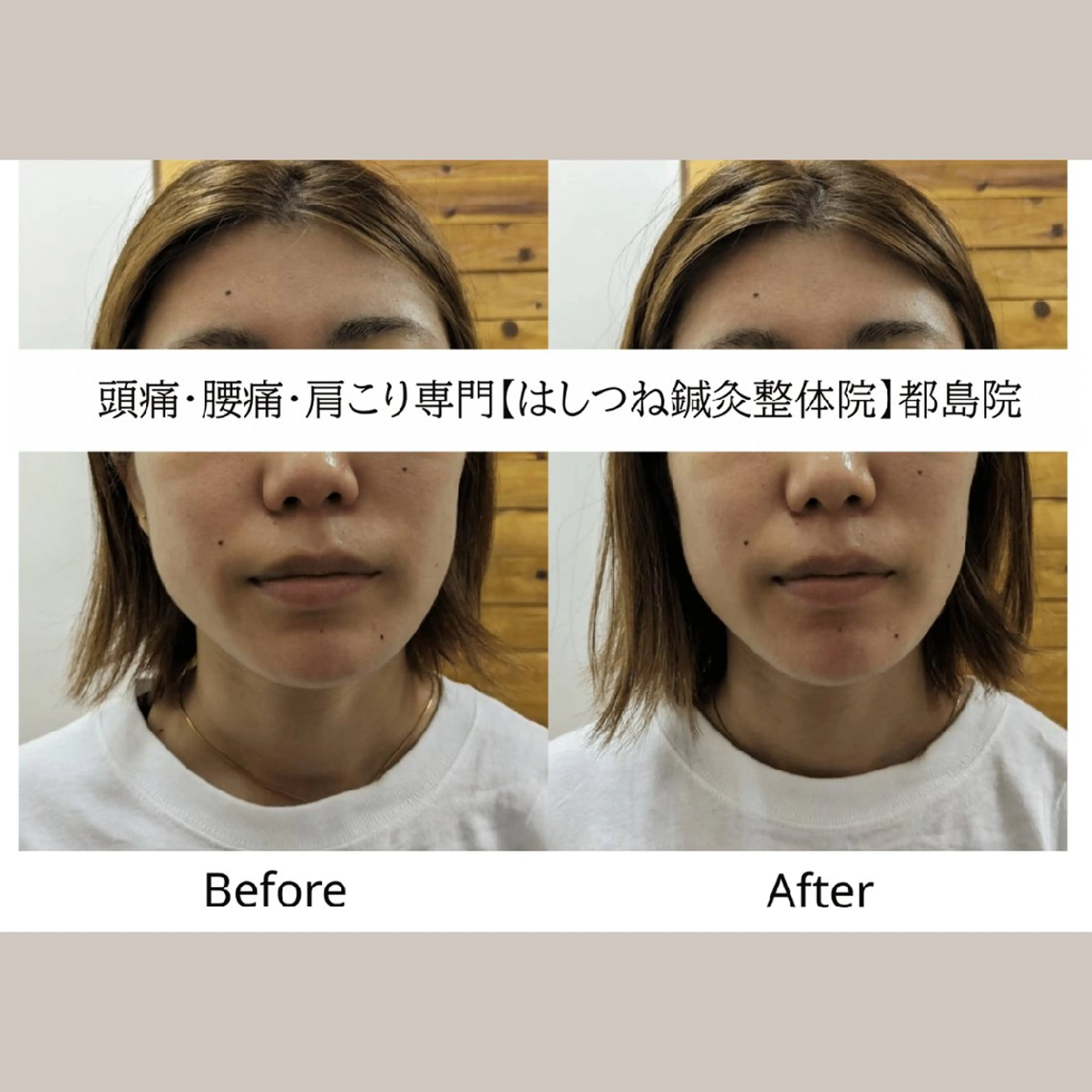 リラク 頭痛・腰痛・美容鍼に 特化してます。　橋岡のエステ・リラクイメージ