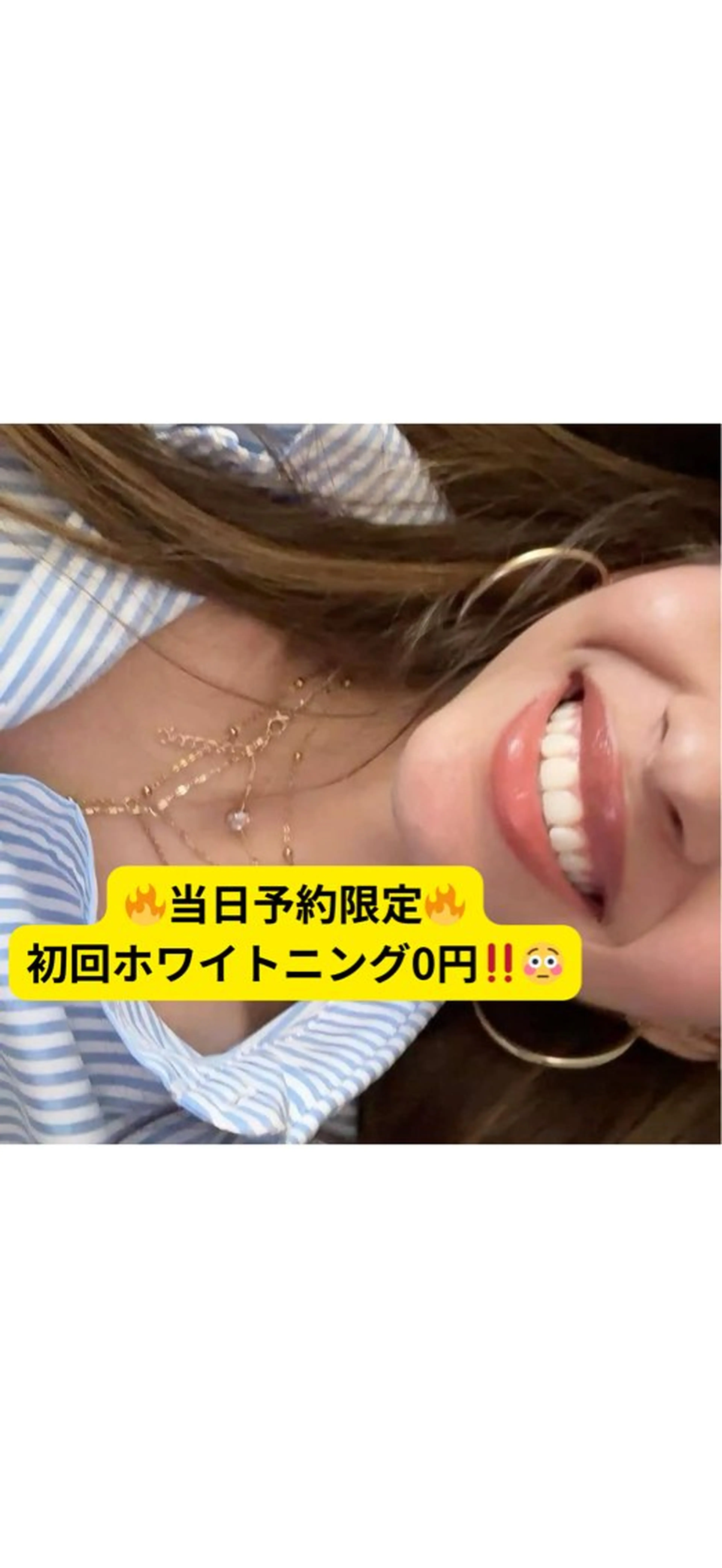 LIBRA自由が丘所属・LIBRA自由が丘 ホワイトニングのその他イメージ