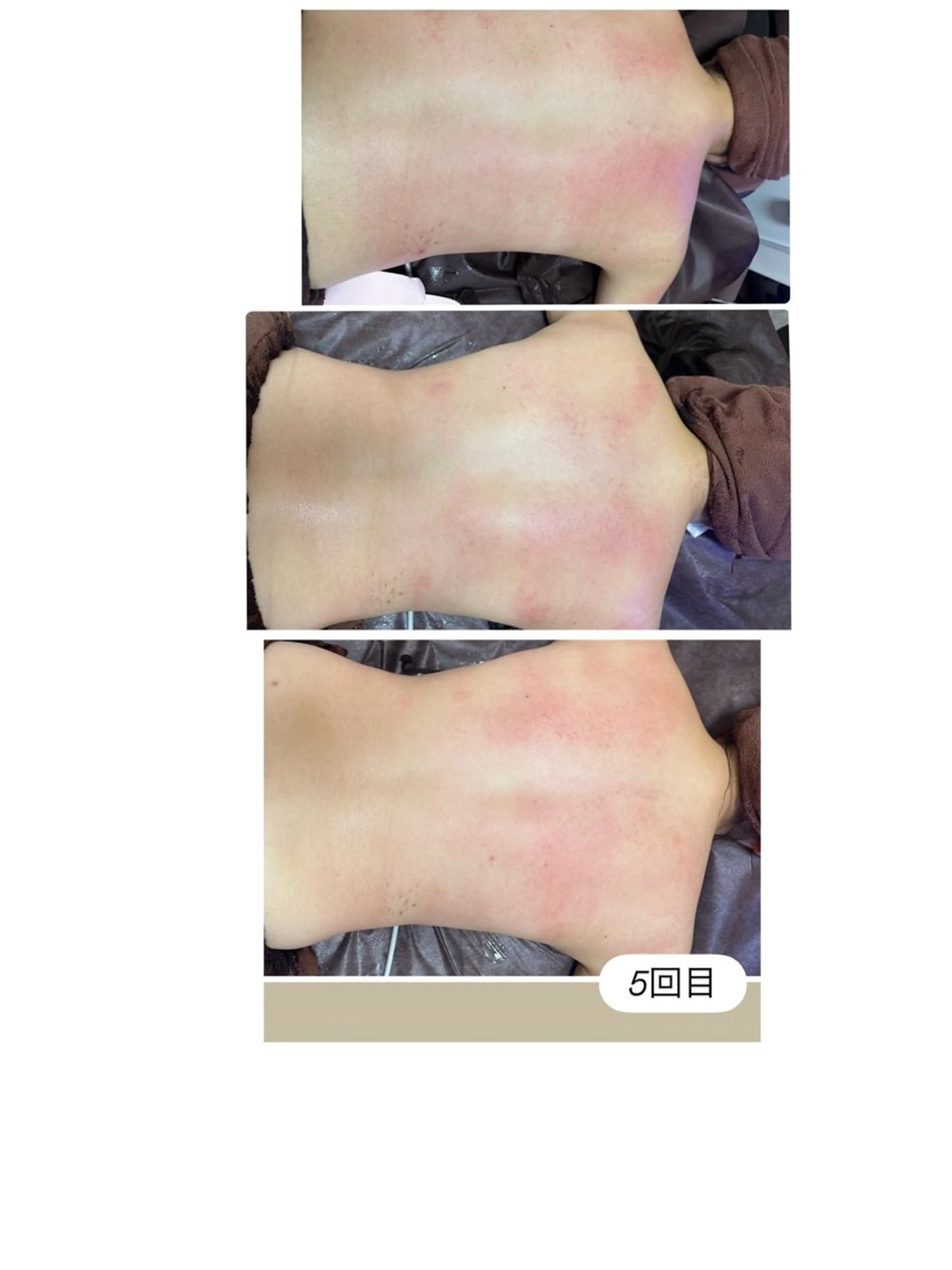 エステ 桐山 まどかのエステ・リラクイメージ