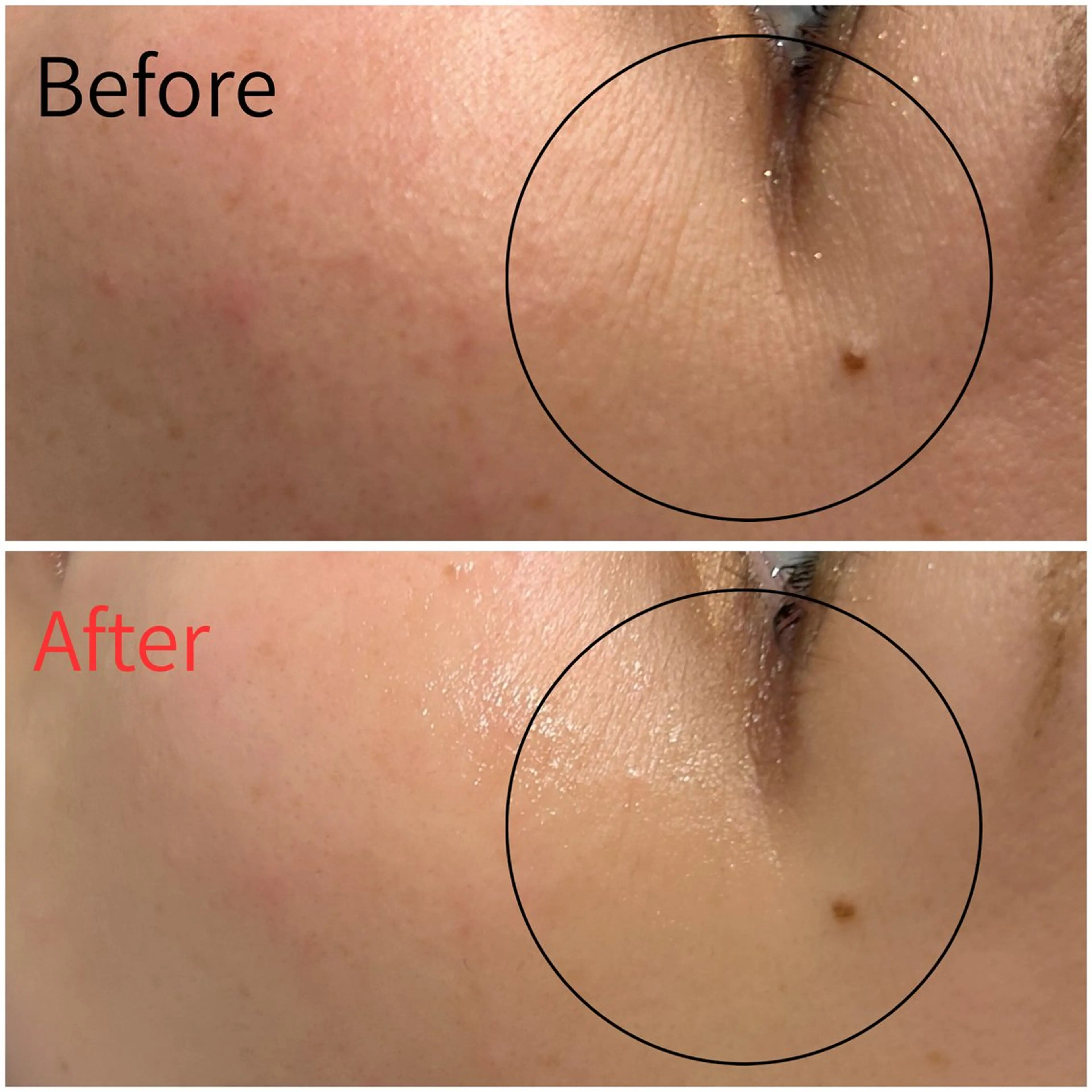 エステ MORE BEAUTY ESTHE 本通り店所属・more 𓍯 のその他イメージ