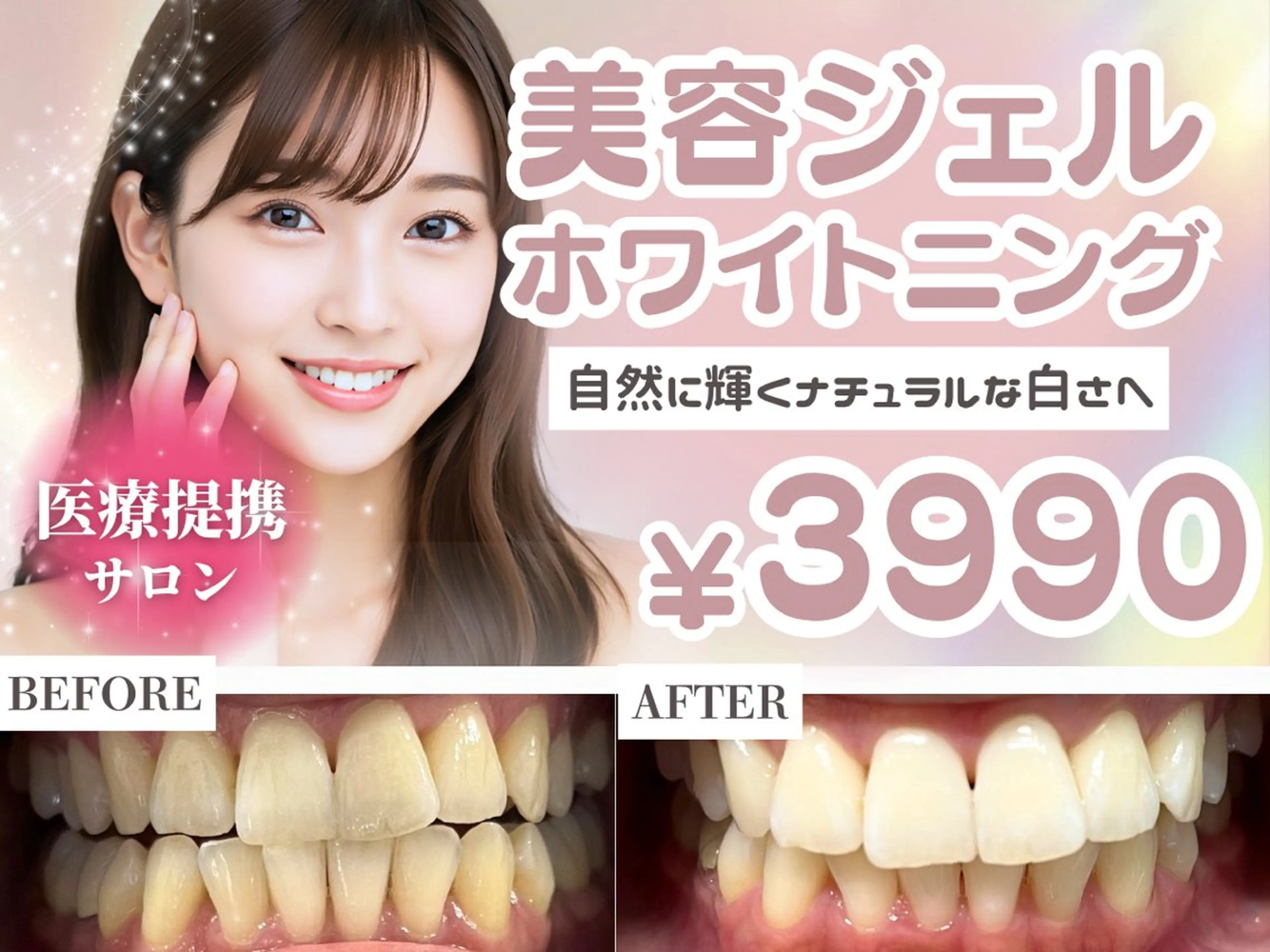 ★この料金で試せるのはこれが最後★10名限定美容ホワイトニング15分×4照射の写真