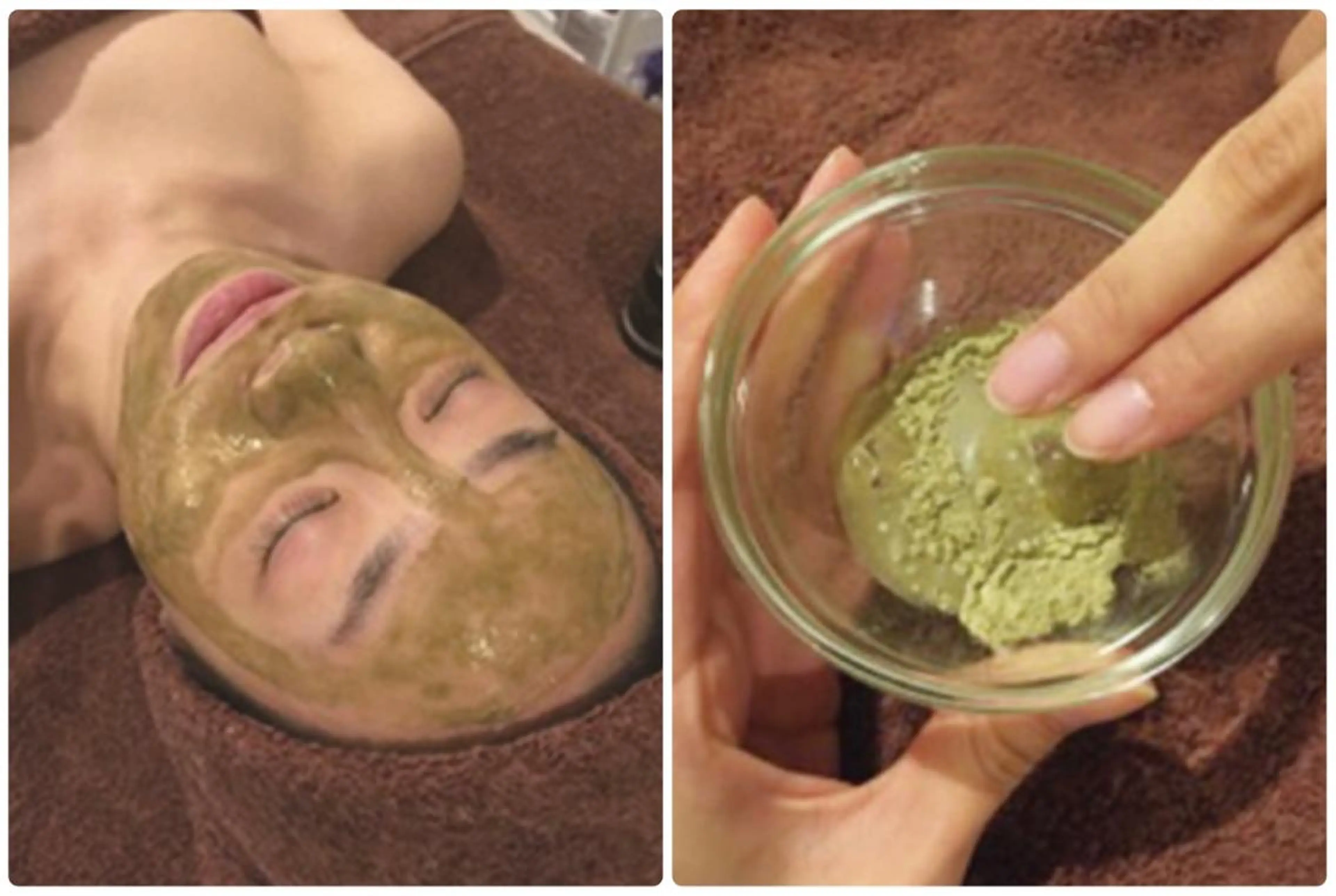 🌿MIDORIハーブピーリング🌿　剥離無しの写真