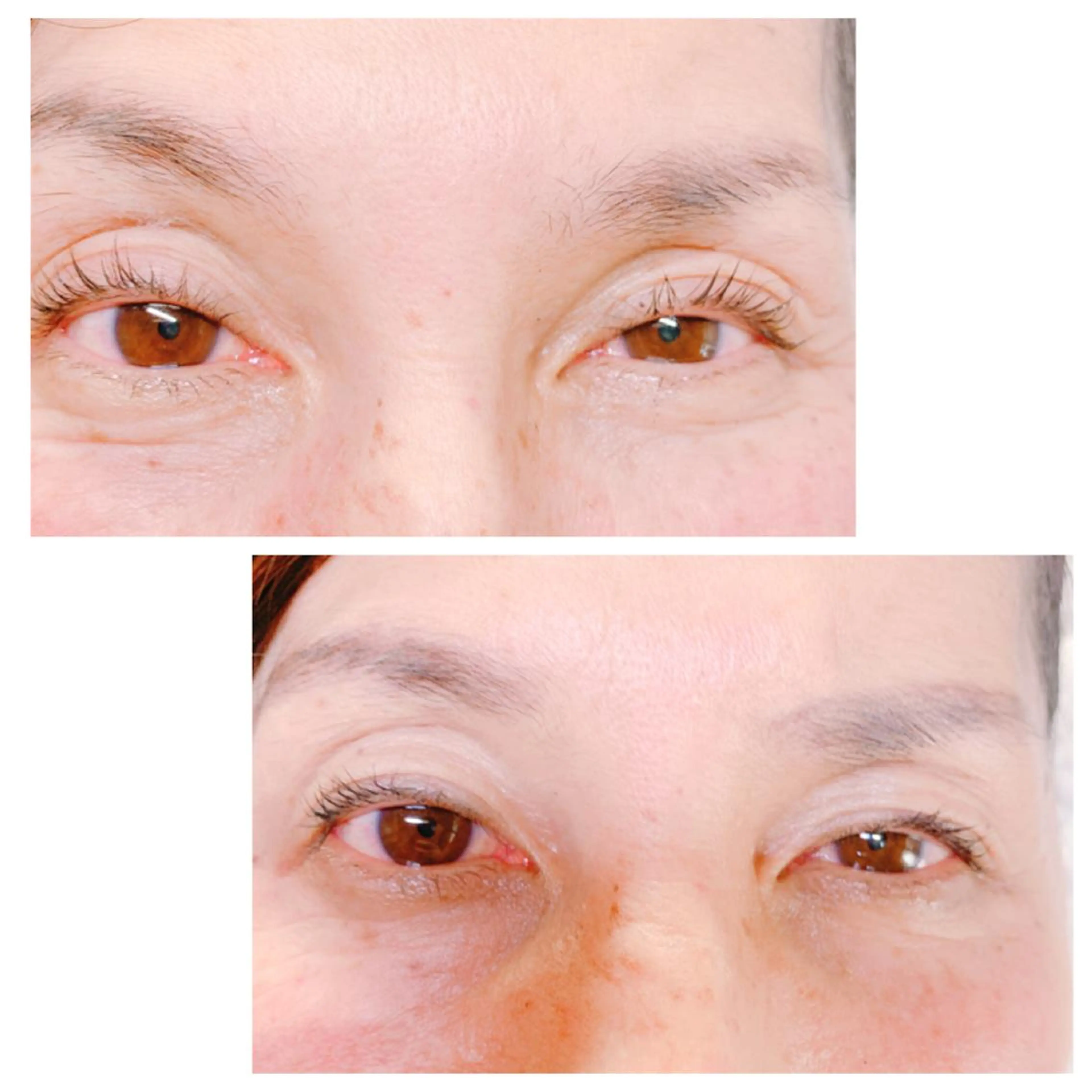 マツエク・マツパ アイリッドアップパーマ マツパ LOVE N°21所属・K△N△♡かな ヘア&まつげのマツエク・マツパデザイン