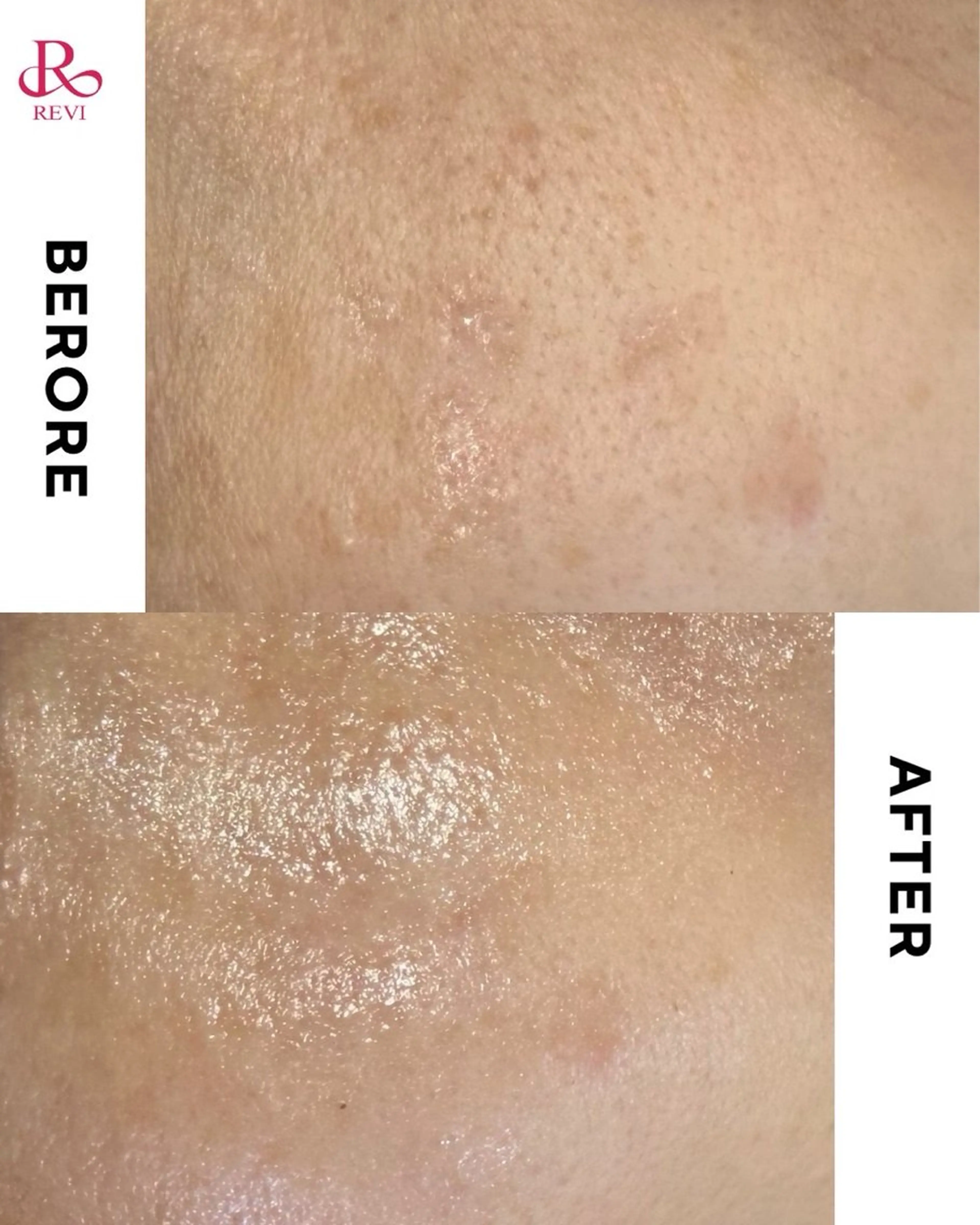 エステ skinity所属・ピーリング専門サロン skinityのエステ・リラクイメージ