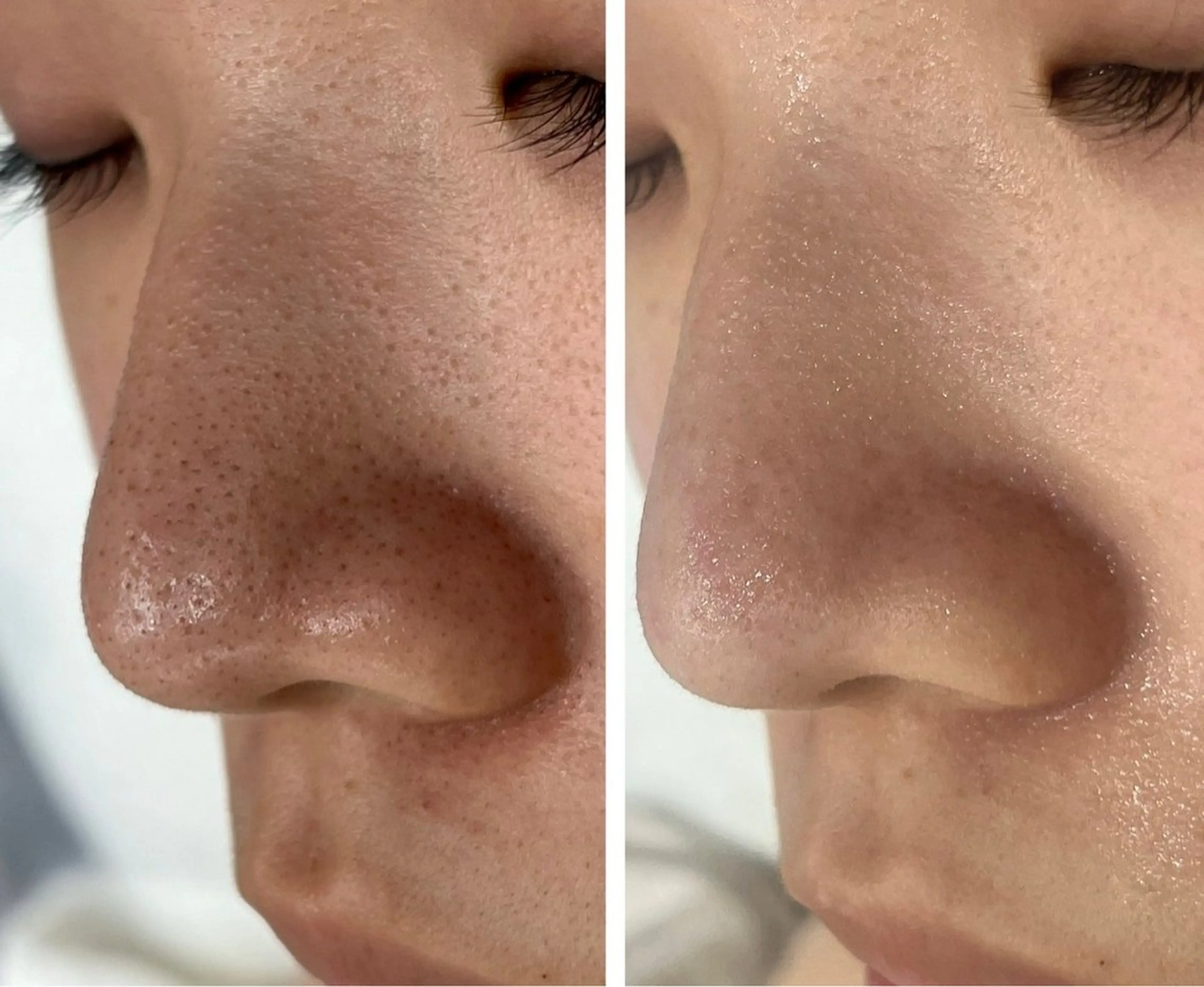 NOAH 小顔毛穴 川越店所属・NOAH ORIEのエステ・リラクイメージ