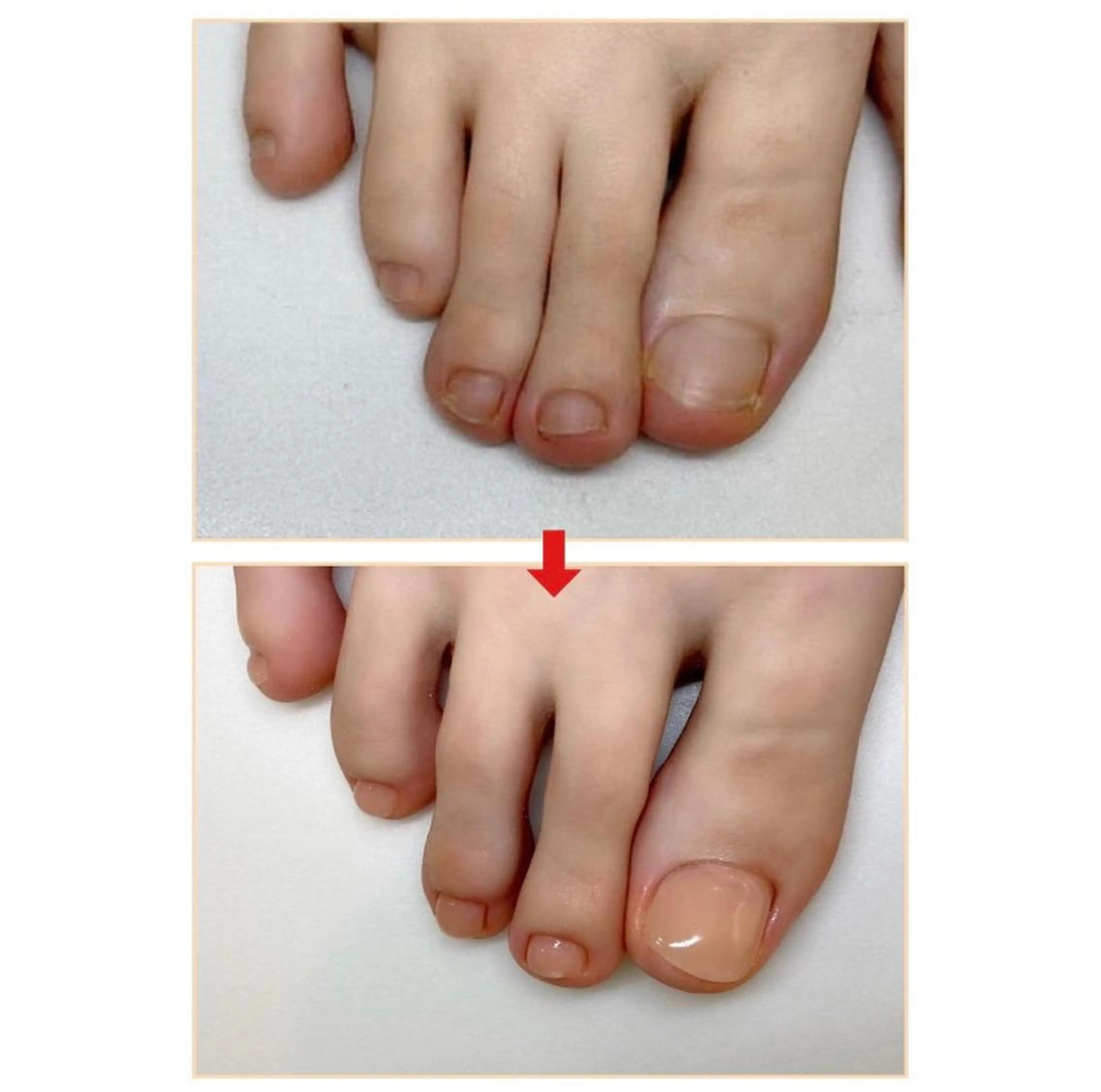 ネイル フットネイル ネイルサロンアリューム所属・ネイルサロン アリュームのネイルデザイン