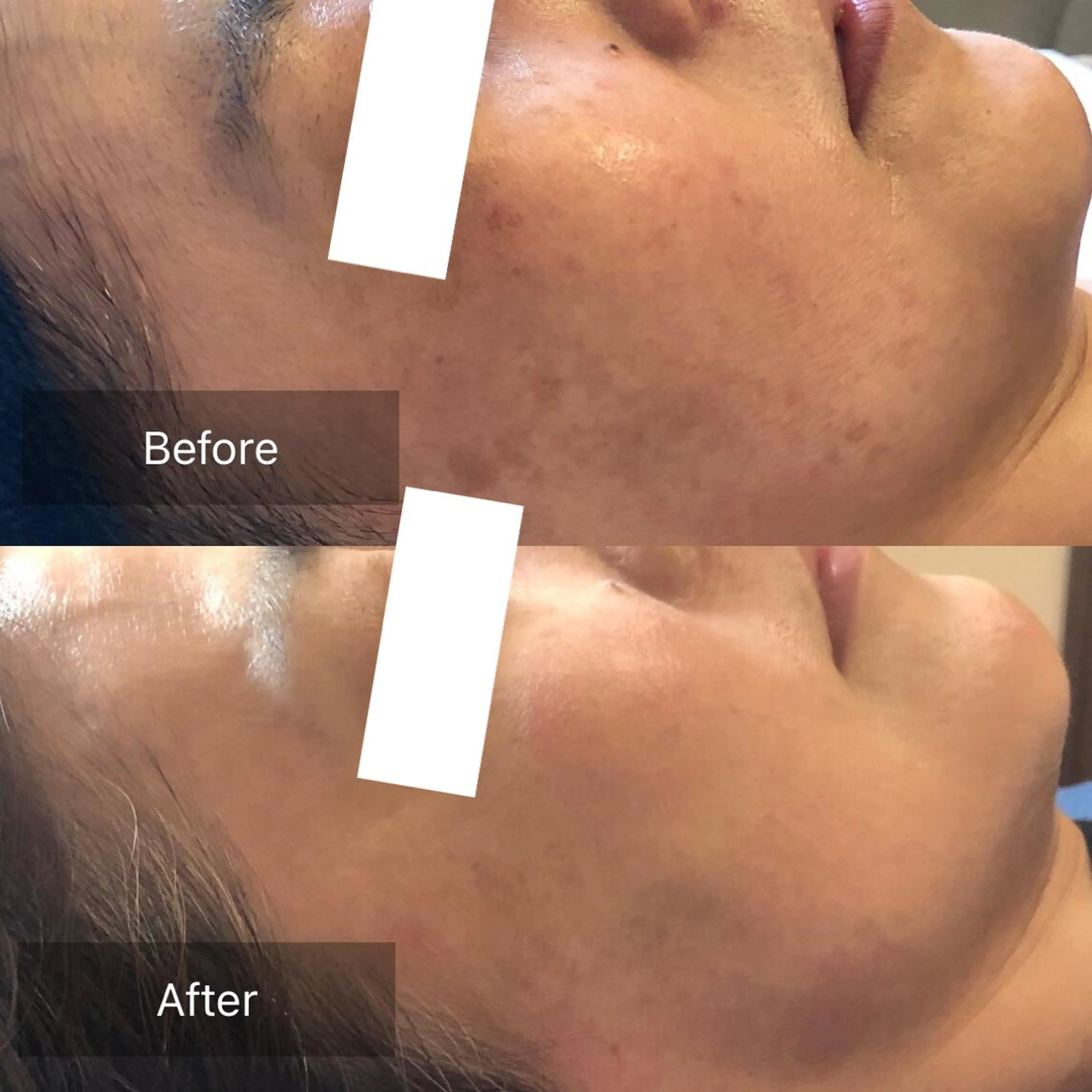 Fleur beauty salon所属・Fleur 児玉聖子のエステ・リラクイメージ