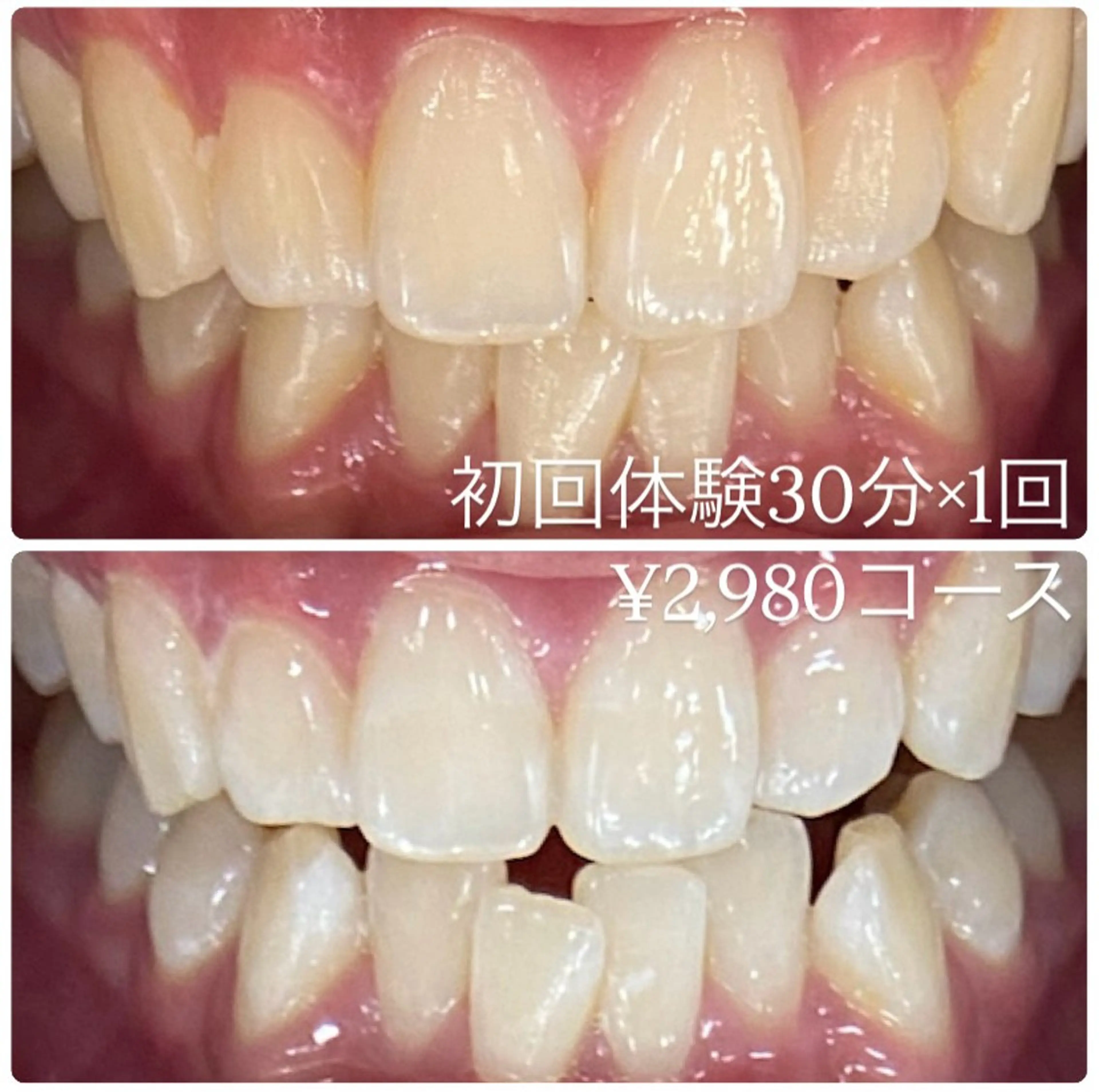 PLATINUM Beauty 横浜店所属・ホワイトニングルーム 横浜店のその他イメージ