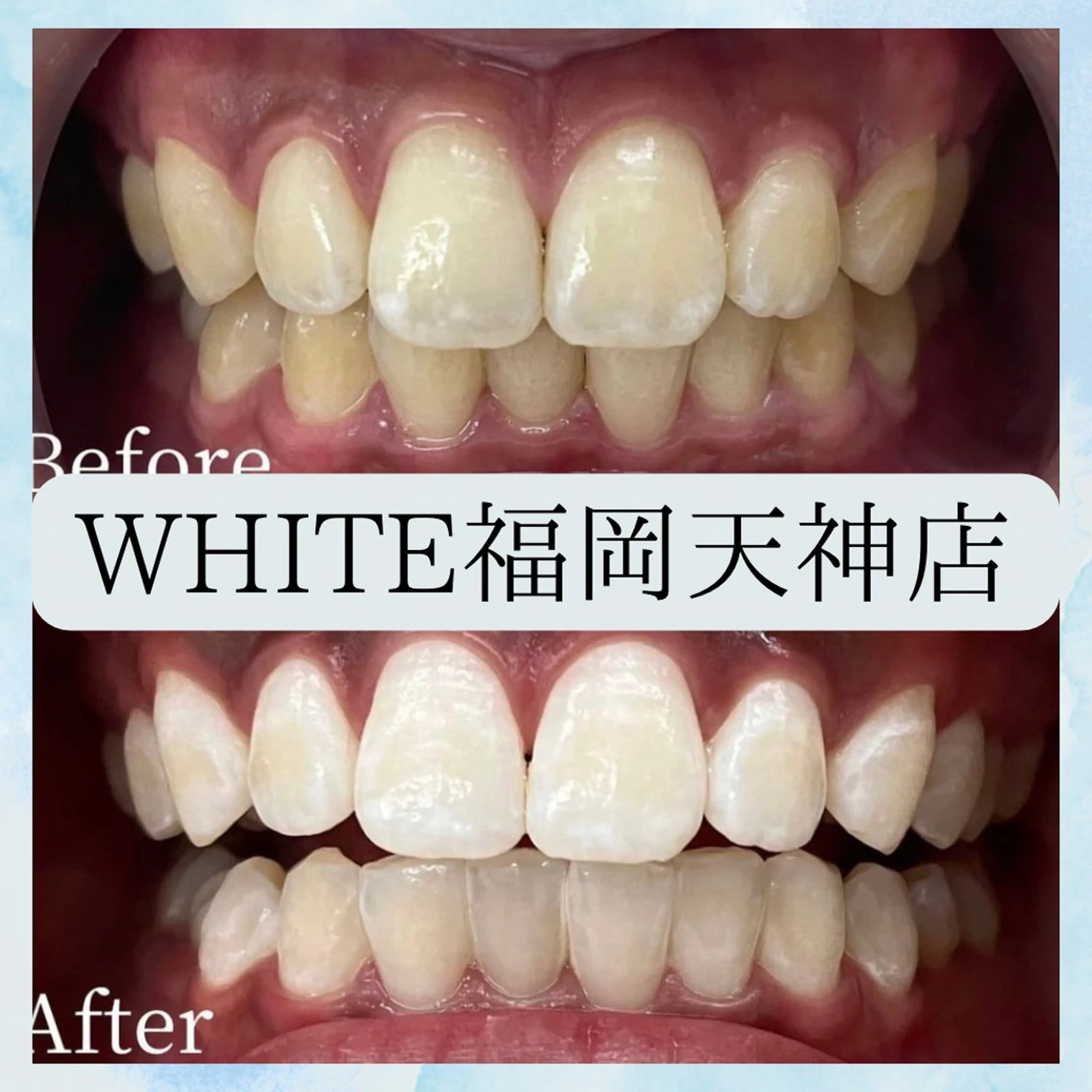 メンズ その他 ホワイトニング専門店 WHITE天神店のエステ・リラクイメージ